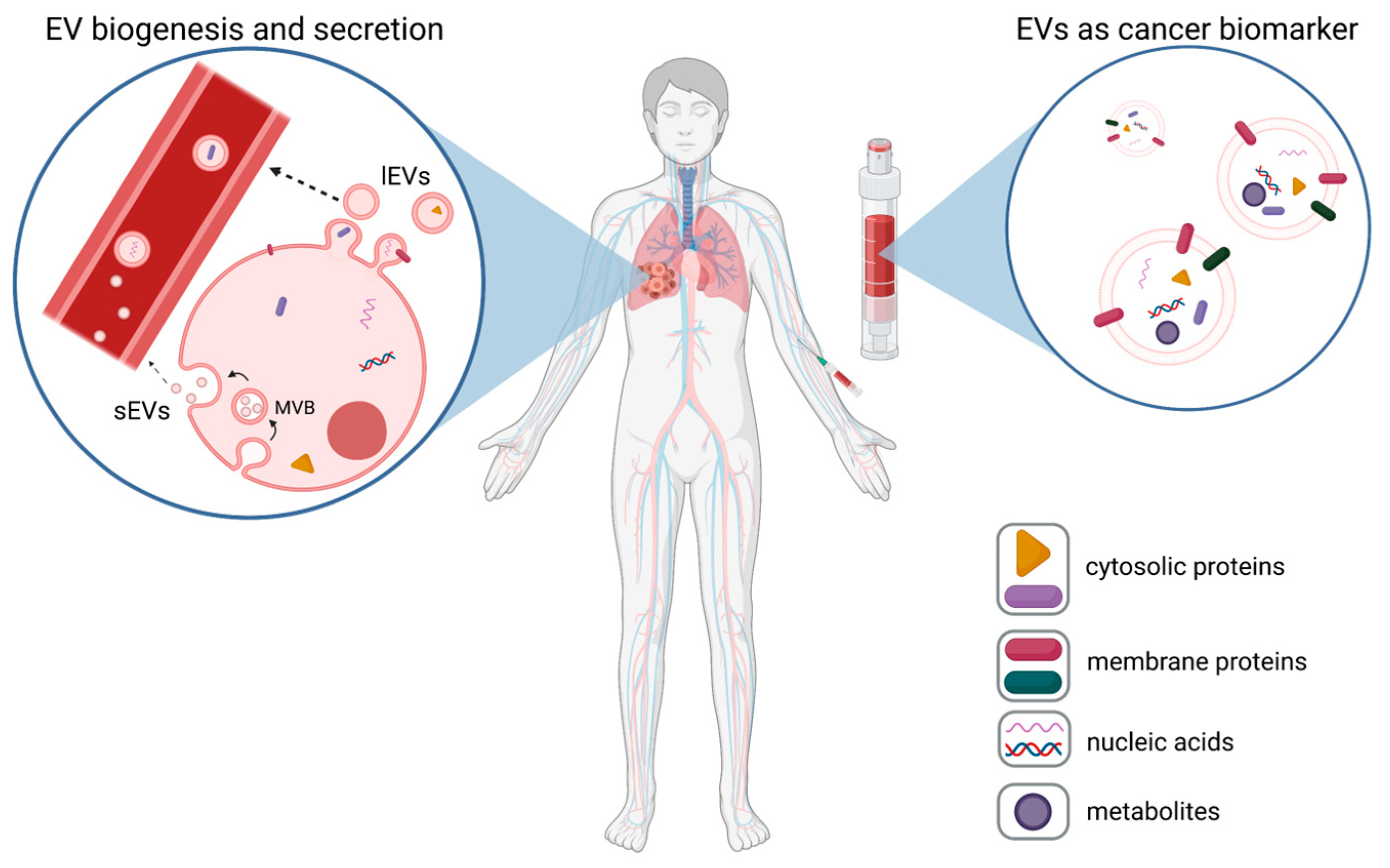 Cancers | Free Full-Text | Extracellular Vesicles in Liquid Biopsies as  Biomarkers for Solid Tumors