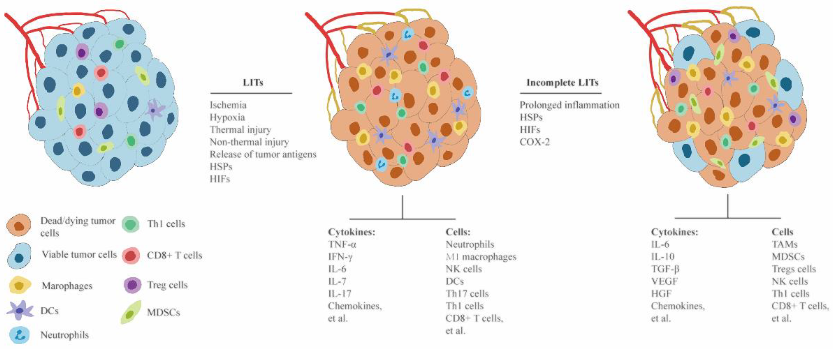 Cancers | Free Full-Text | How Biology Guides the Combination of  Locoregional Interventional Therapies and Immunotherapy for Hepatocellular  Carcinoma: Cytokines and Their Roles