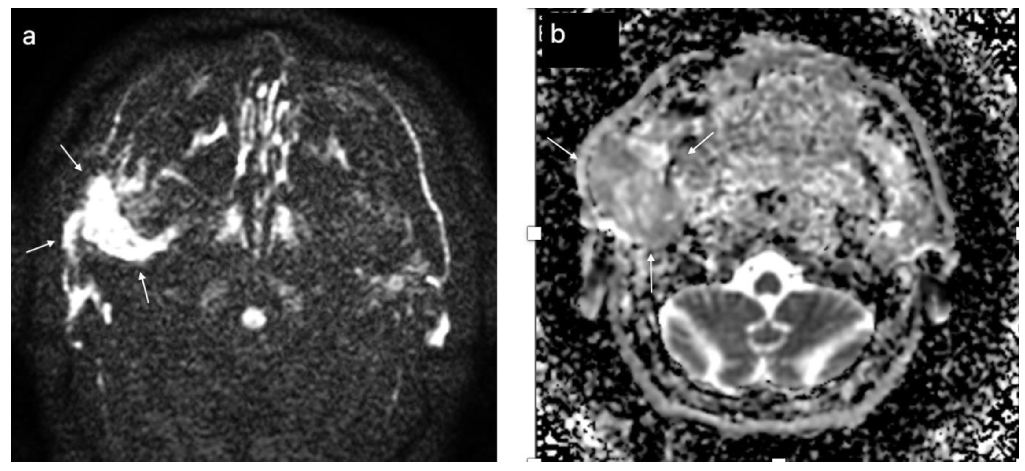 Cancers Free Full Text The Value Of Multiparametric Magnetic Resonance Imaging In The