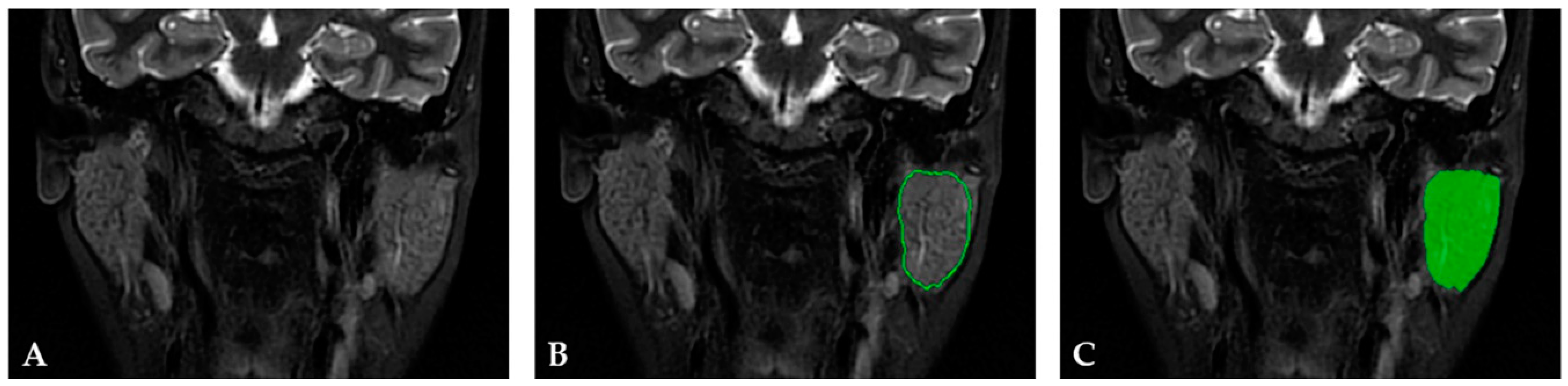 Cancers 15 01380 g001