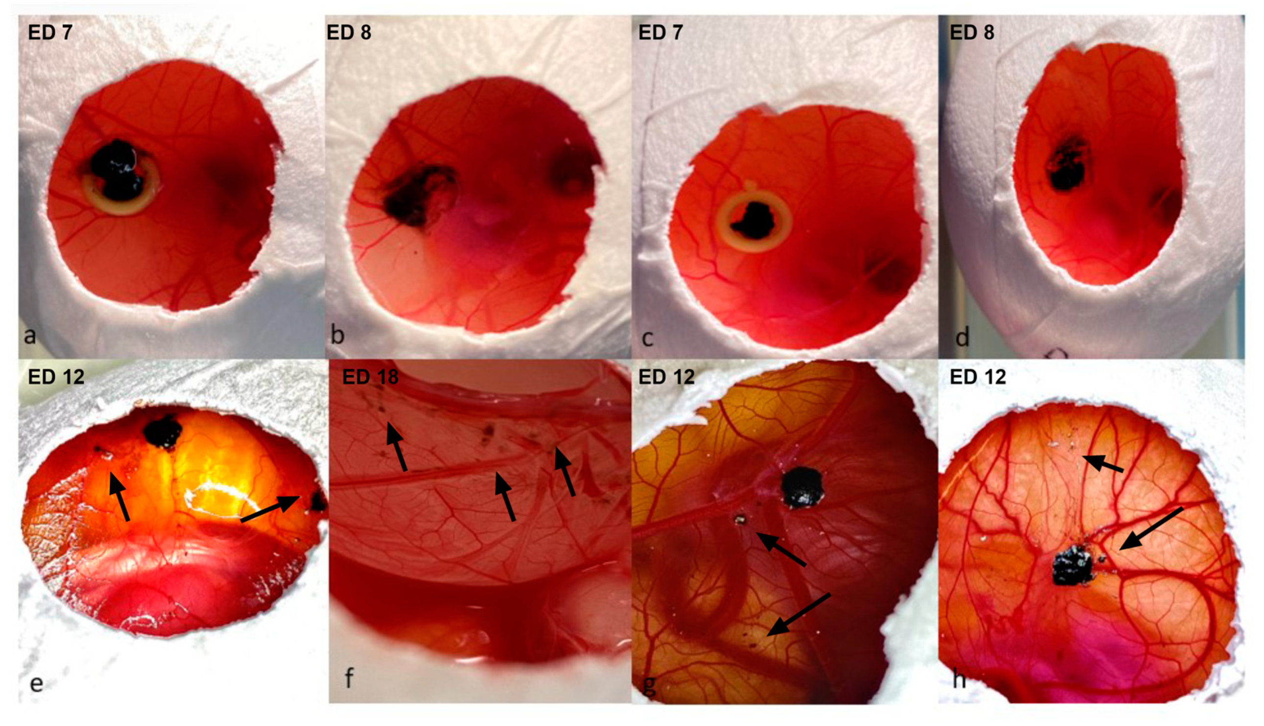 Cancers 15 01436 g004 Cancers 15 01436 g004