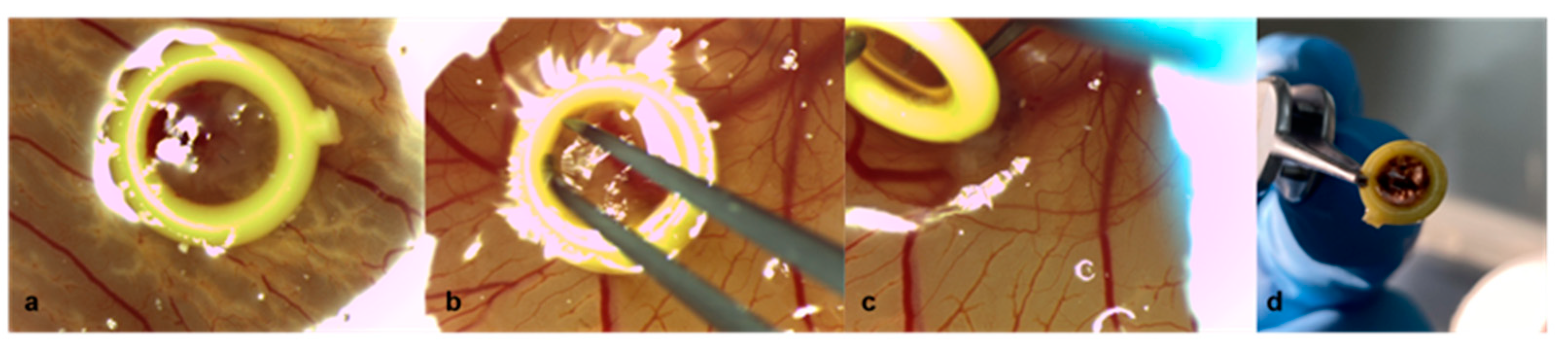 Cancers 15 01436 g005 Cancers 15 01436 g005