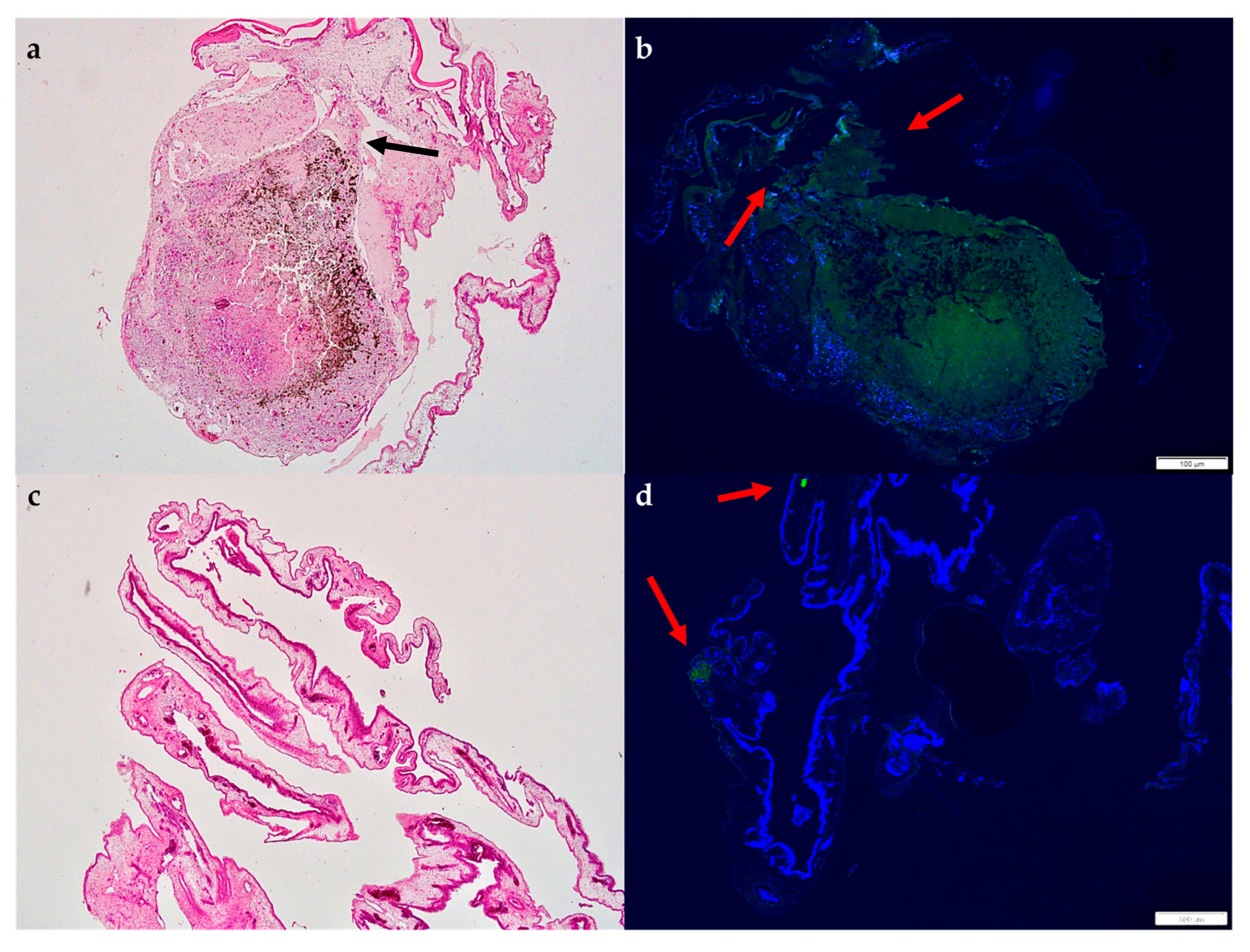Cancers 15 01436 g012 Cancers 15 01436 g012