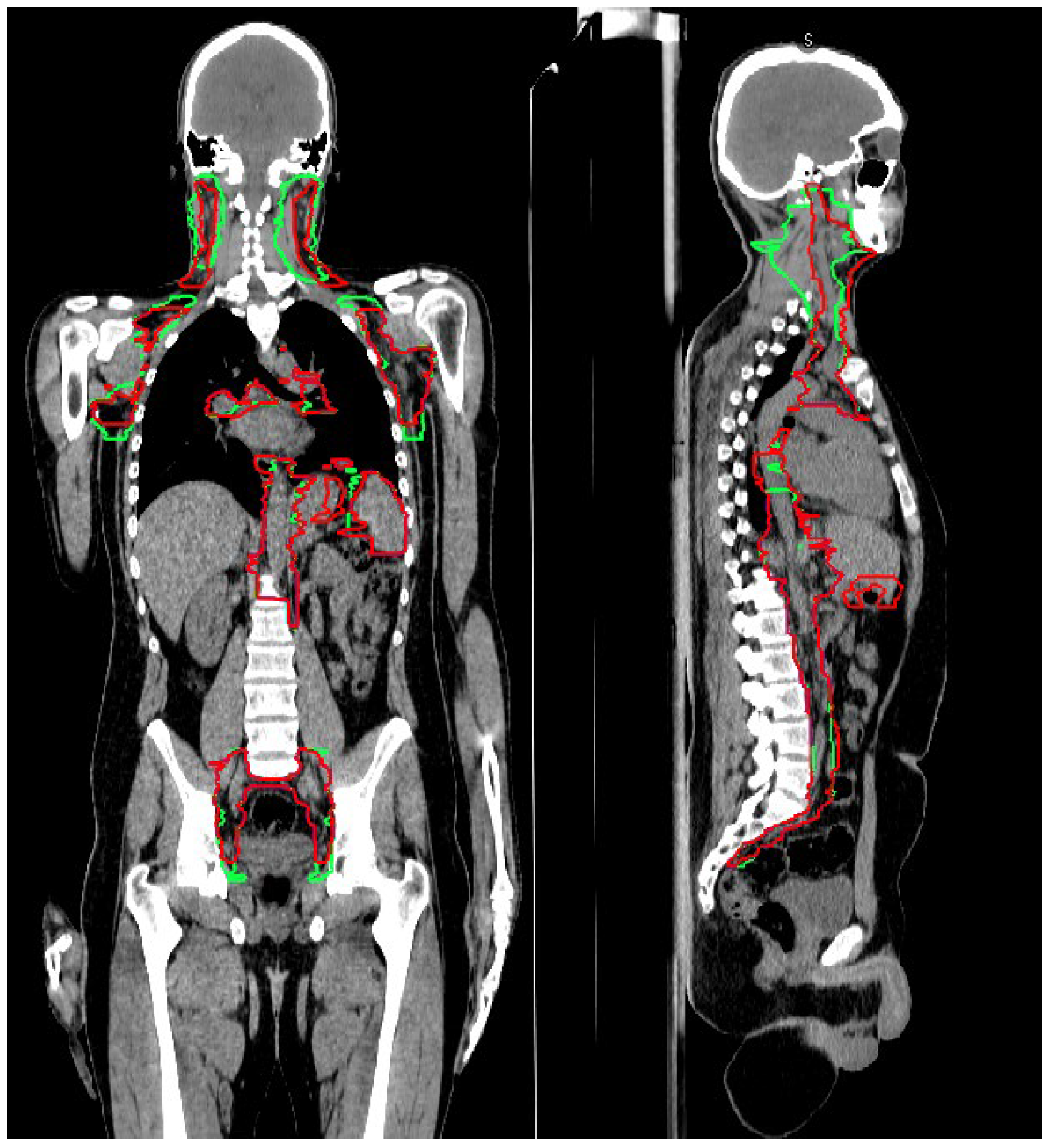 Cancers 15 01536 g002