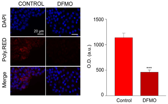 Cancers | Free Full-Text | Transcriptional Basis of Ca2+