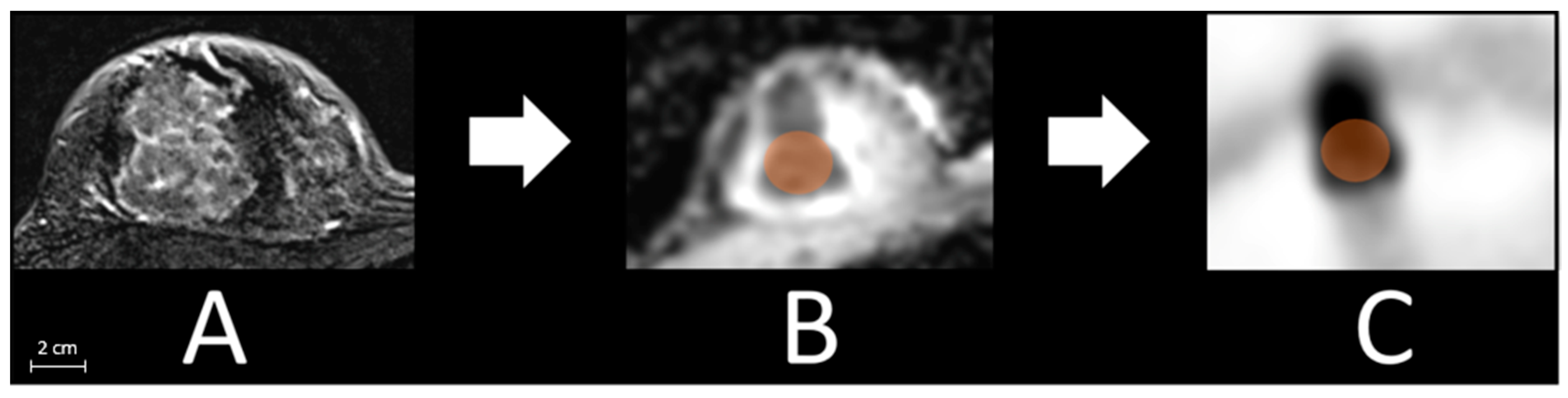 Frontiers  Multiparametric magnetic resonance imaging-derived