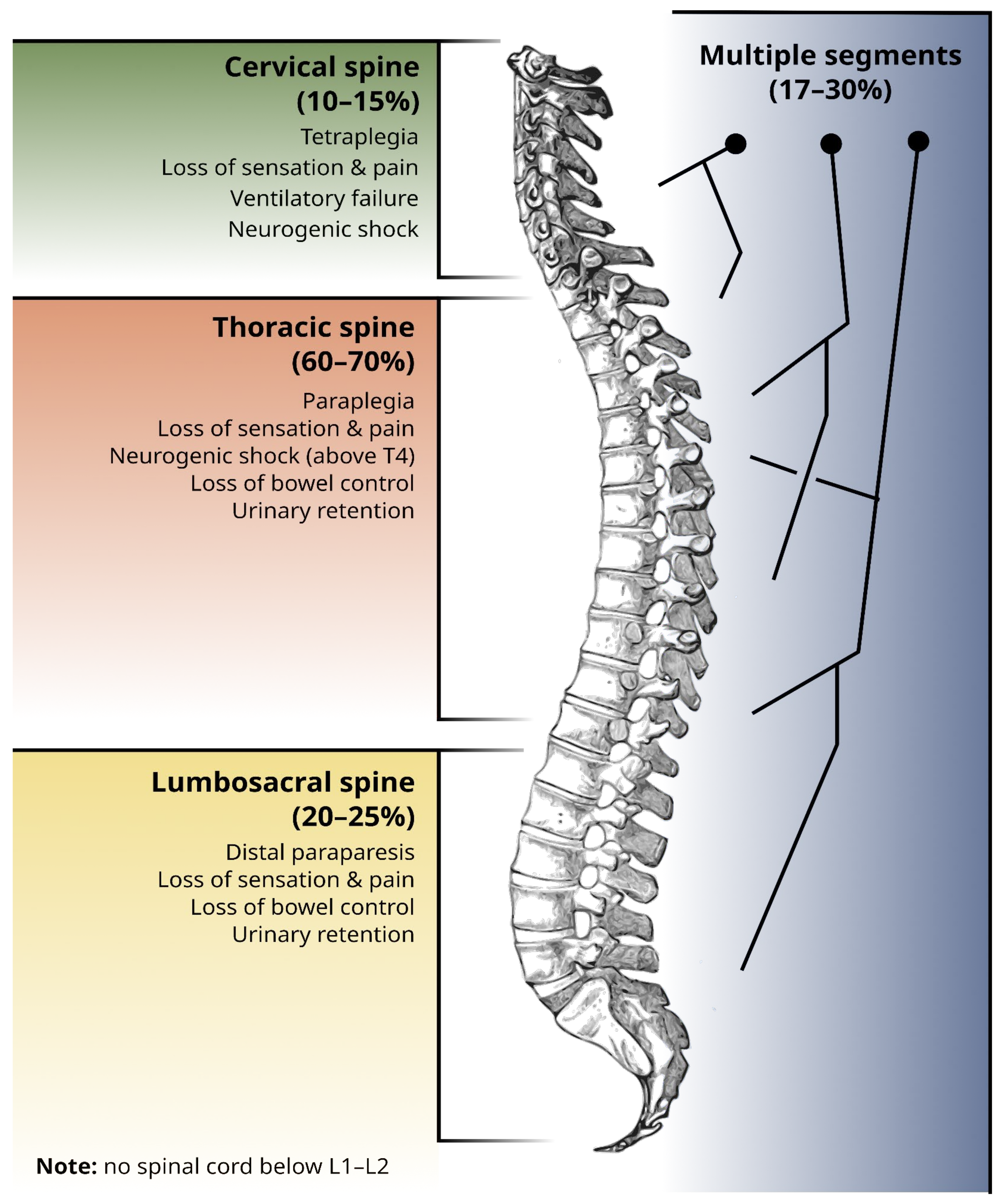 The vertebral compression ratio is calculated using the following