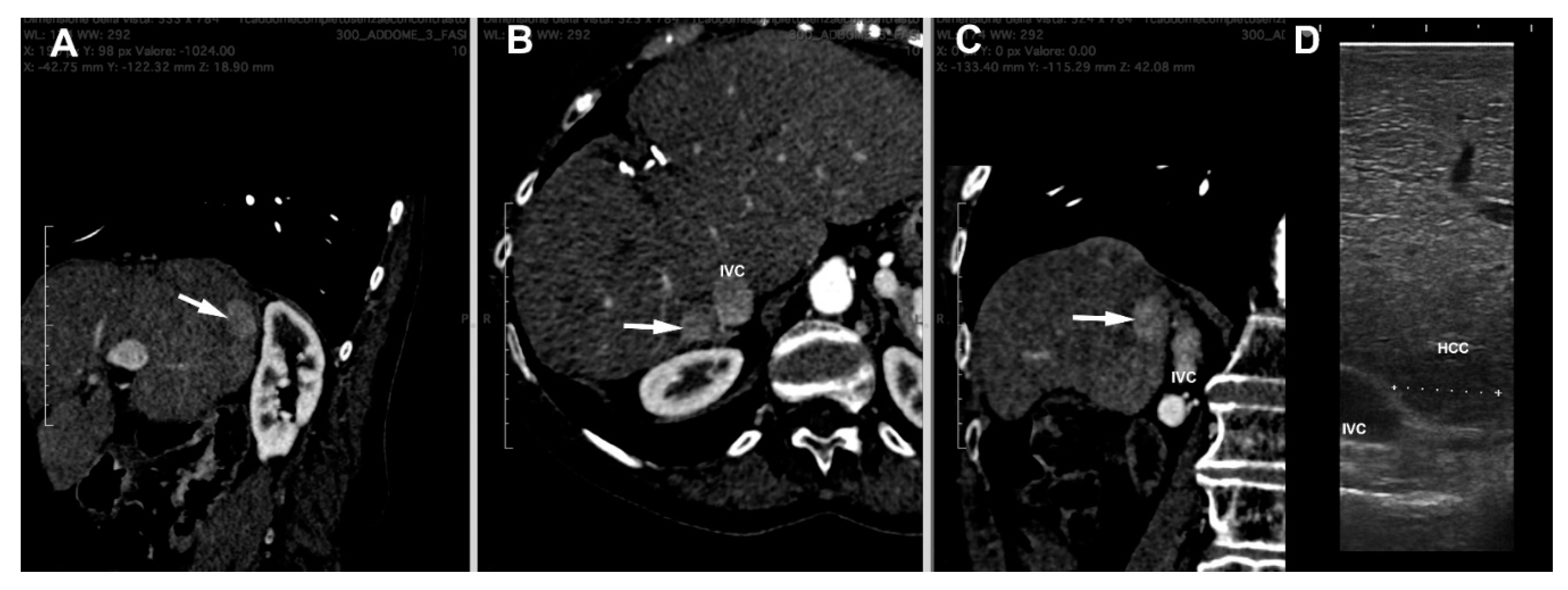 Cancers 15 01814 g002 Cancers 15 01814 g002
