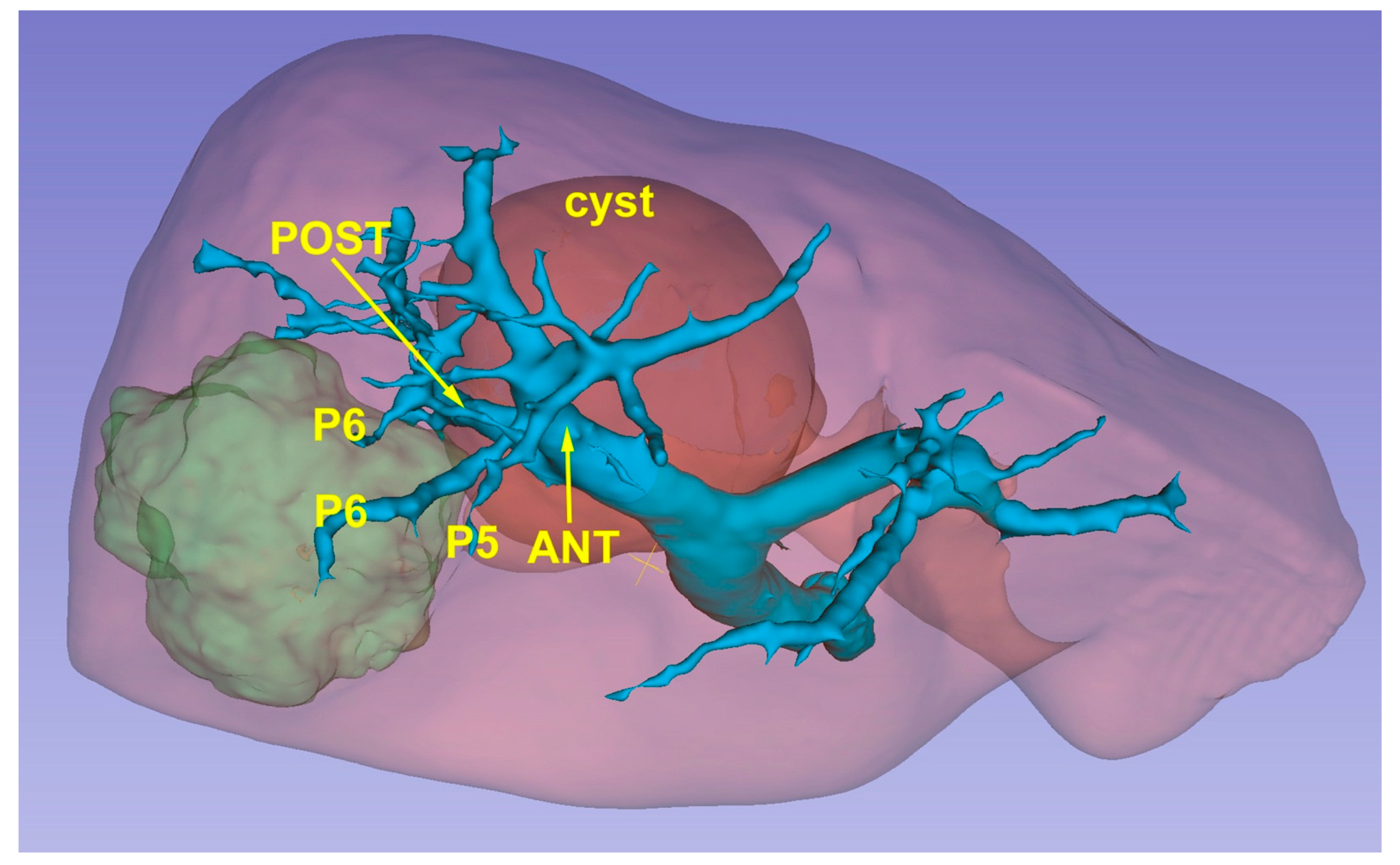 Cancers 15 01814 g003 Cancers 15 01814 g003