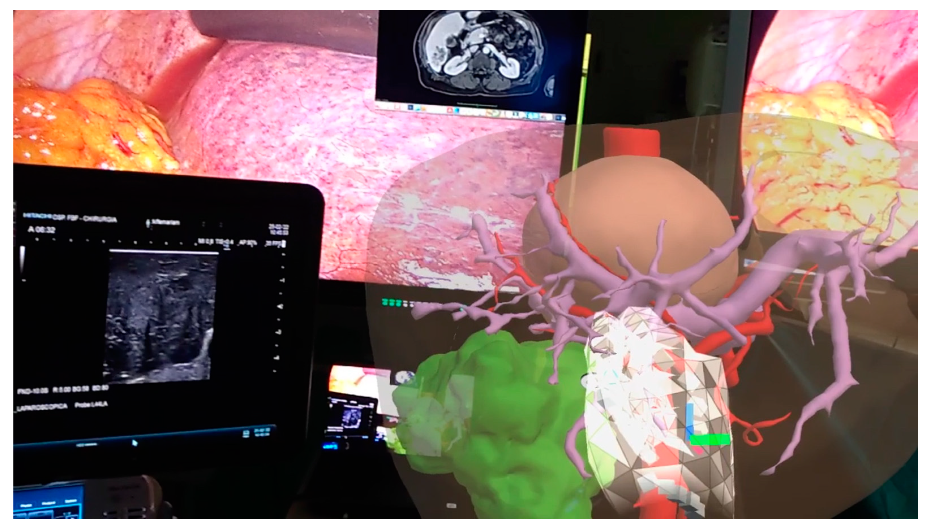 Cancers 15 01814 g004 Cancers 15 01814 g004