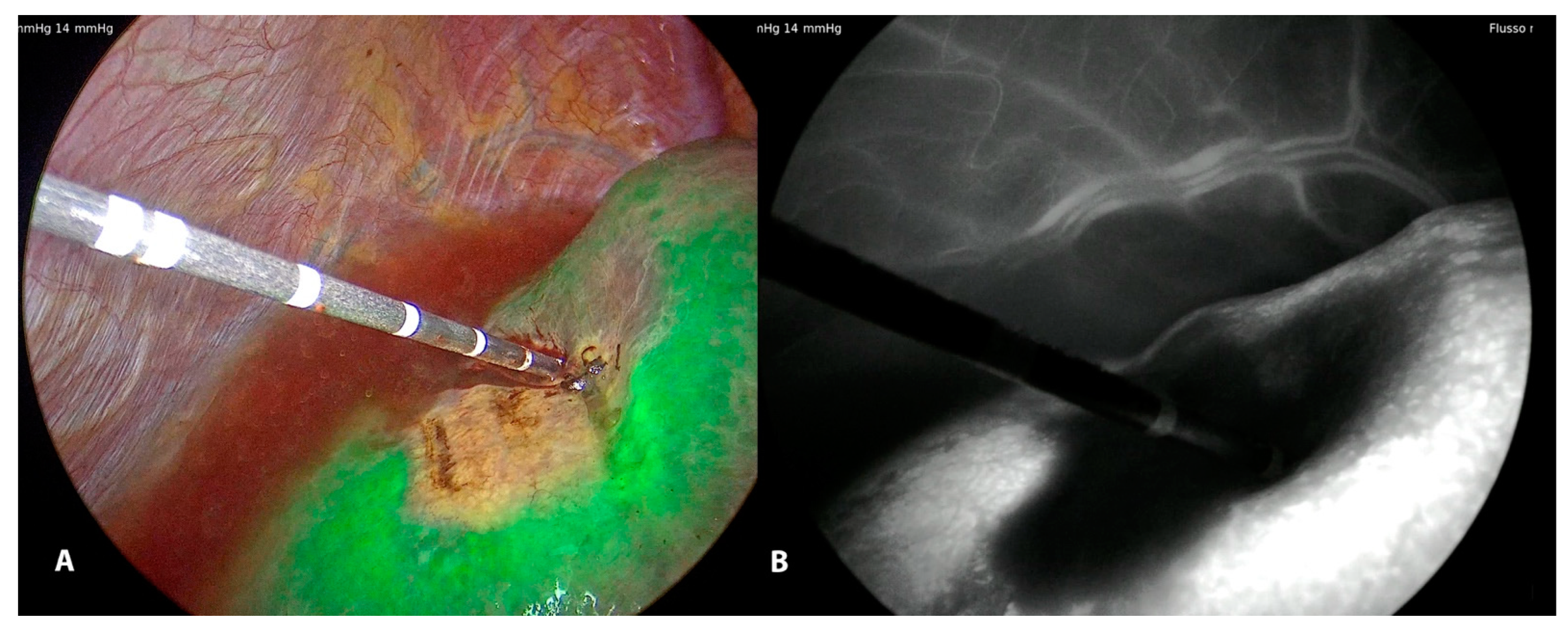 Cancers 15 01814 g005 Cancers 15 01814 g005