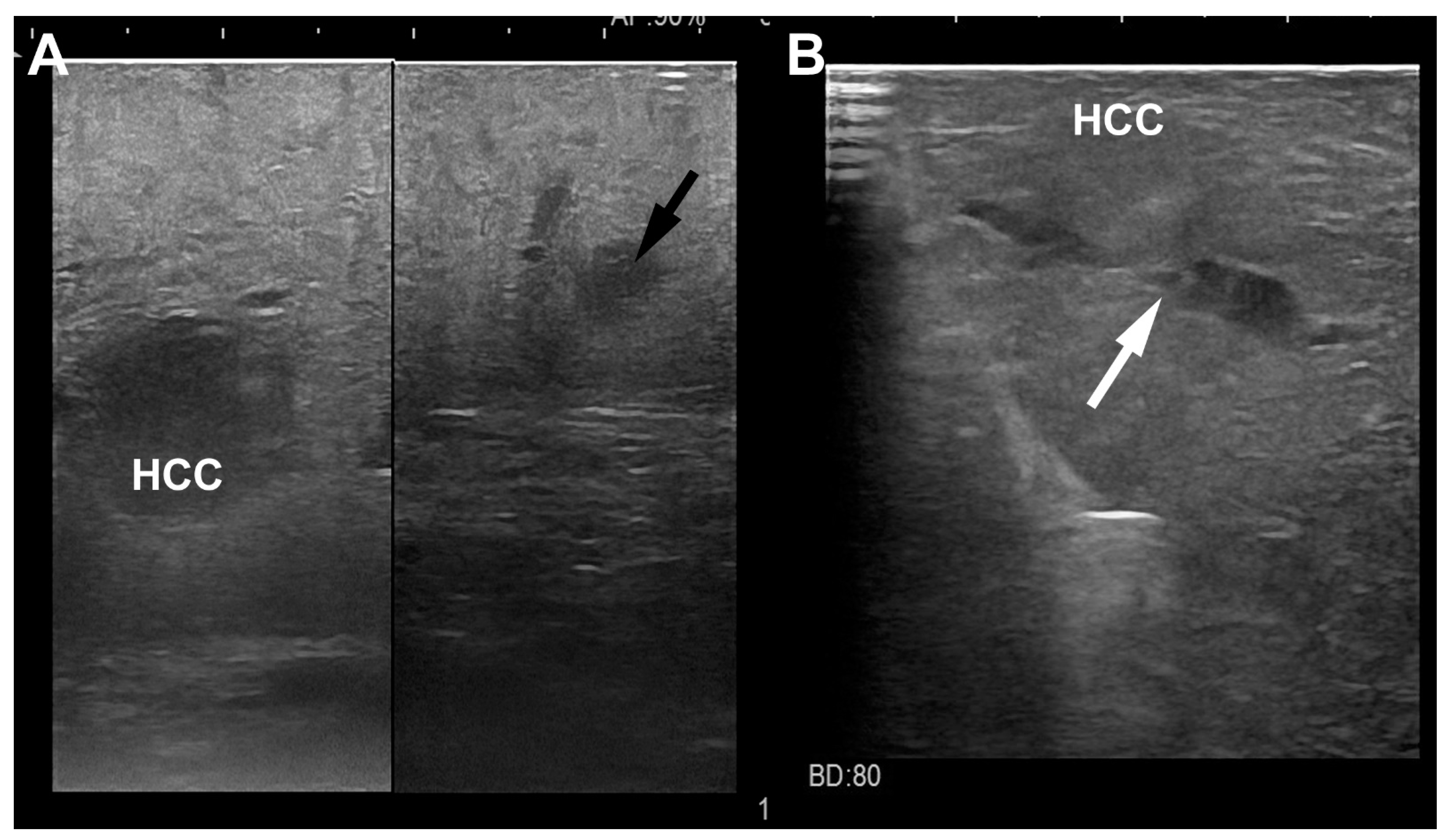 Cancers 15 01814 g006 Cancers 15 01814 g006