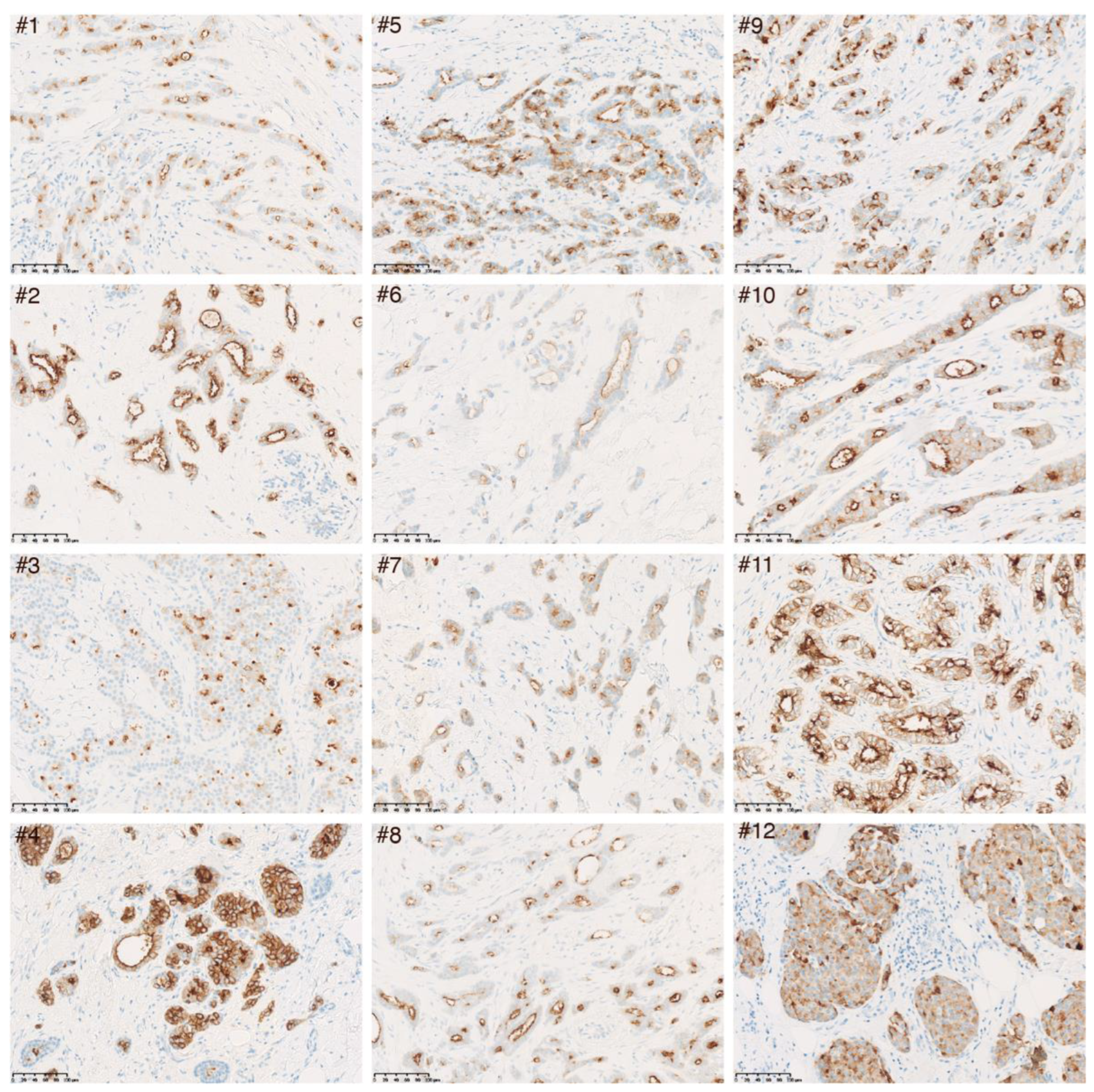 Cancers 15 01830 g003 Cancers 15 01830 g003