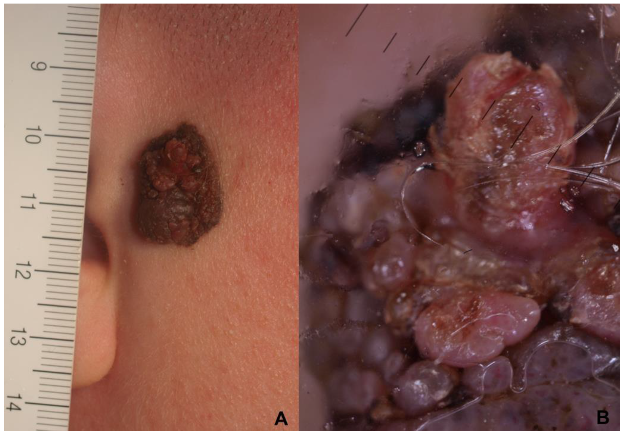 Cancers 15 01835 g003 Cancers 15 01835 g003