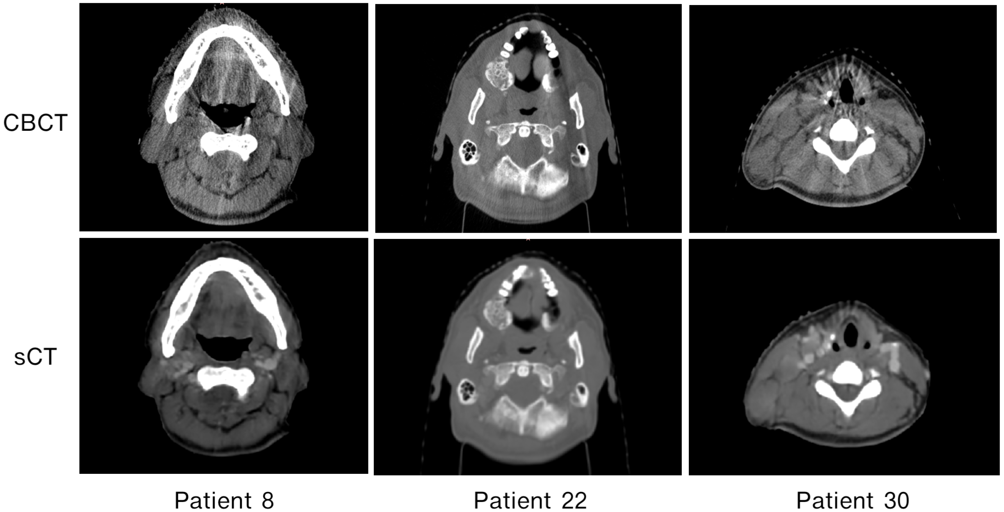 Cancers Free Full Text Cbct To Ct Translation Using Registration Based Generative