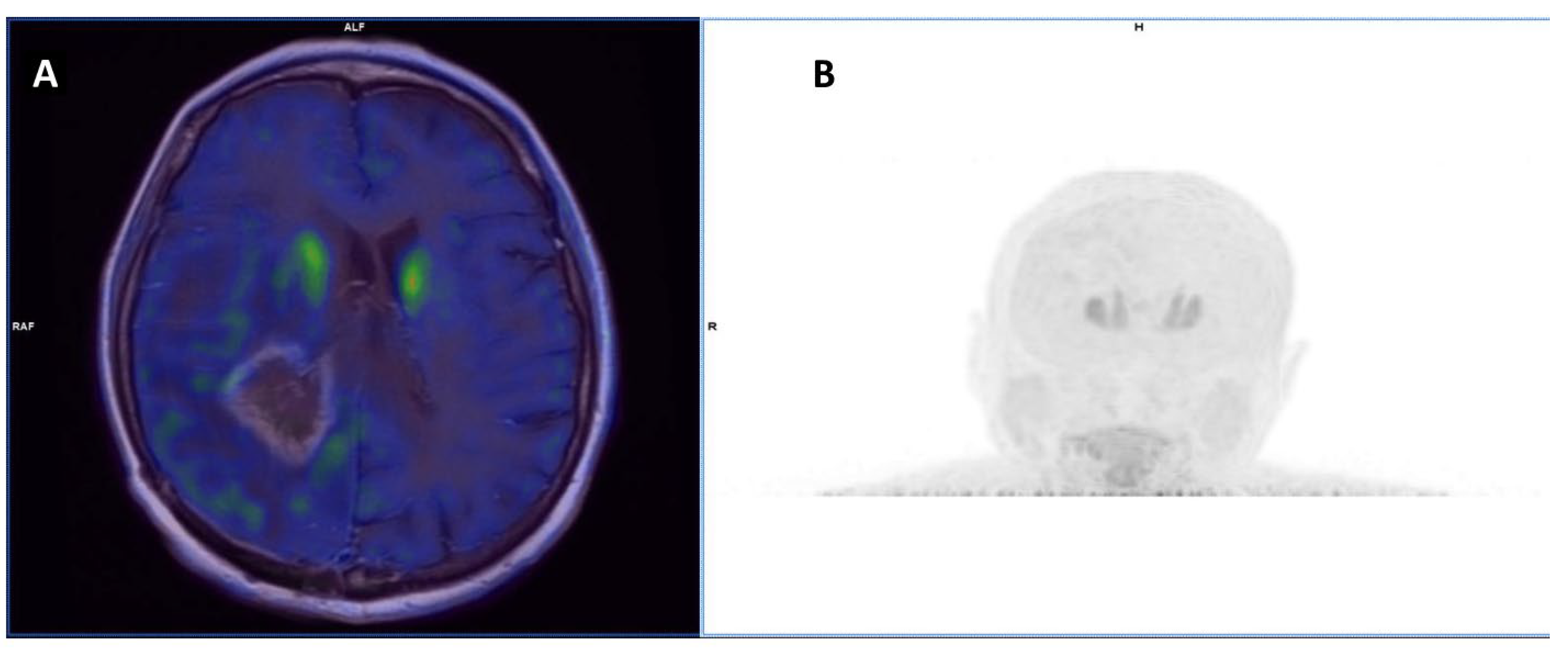 Cancers 15 02184 g003 Cancers 15 02184 g003