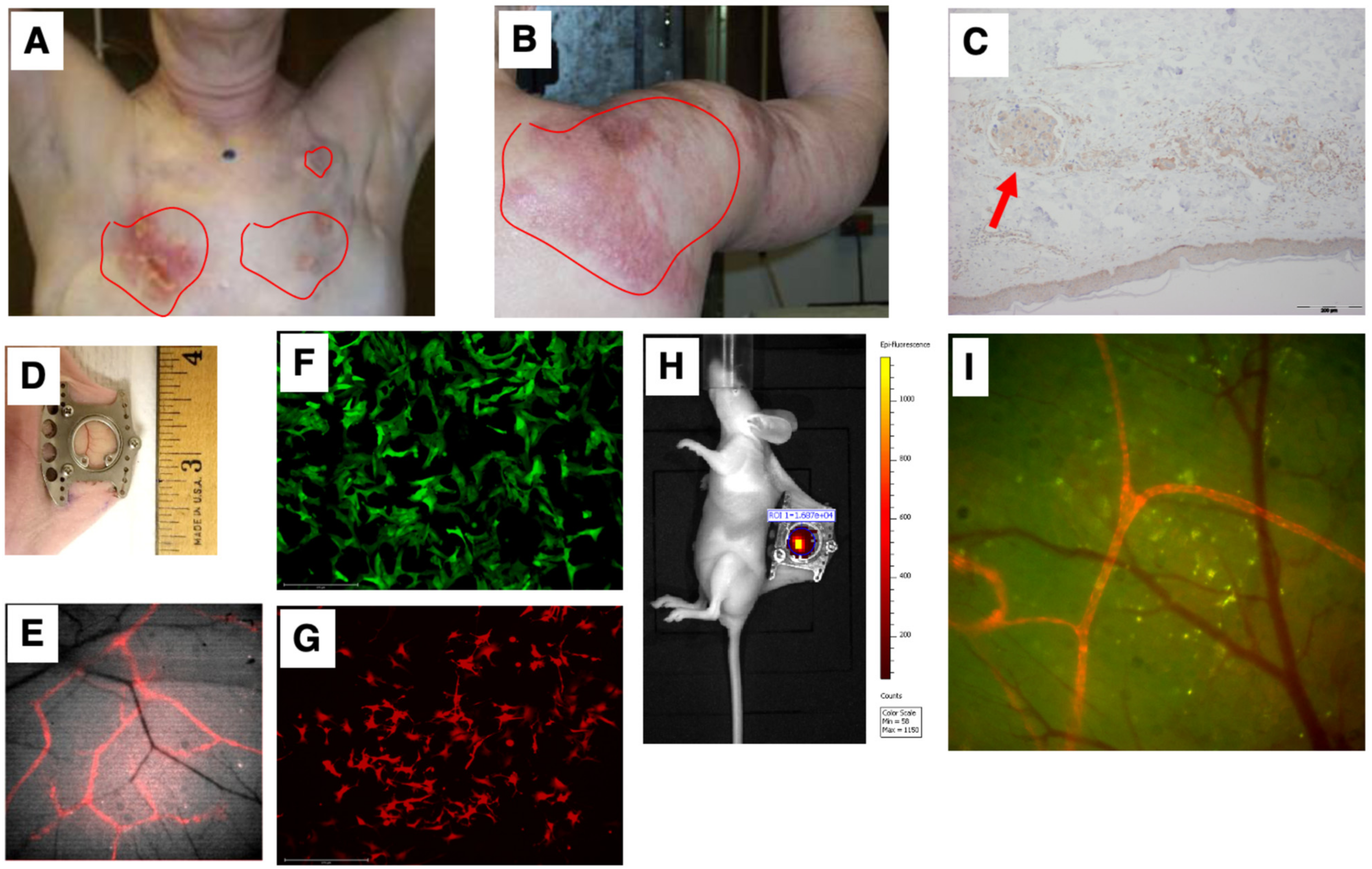 Cancers 15 02261 g003