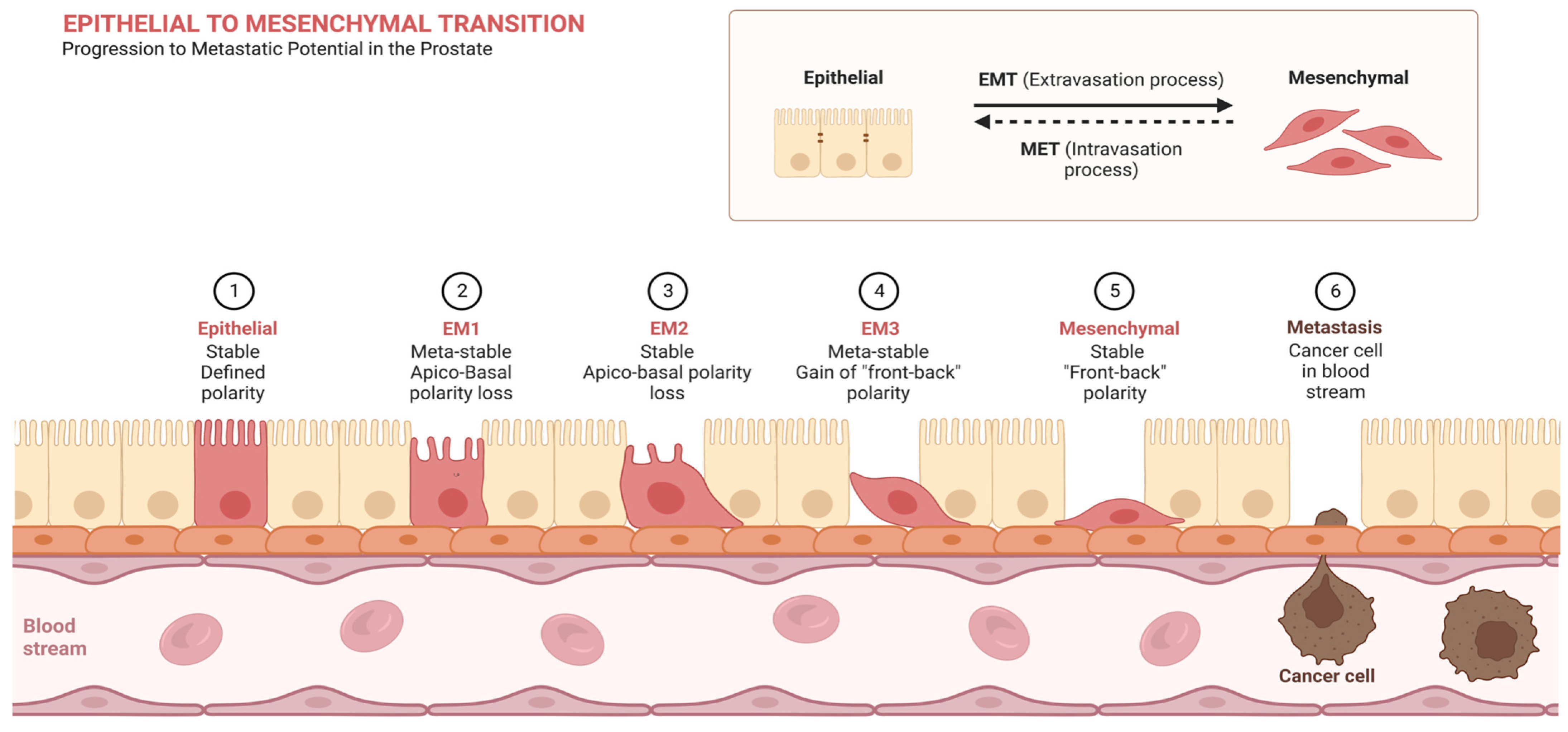 Cancers | Free Full-Text | Epithelial-to-Mesenchymal Transition