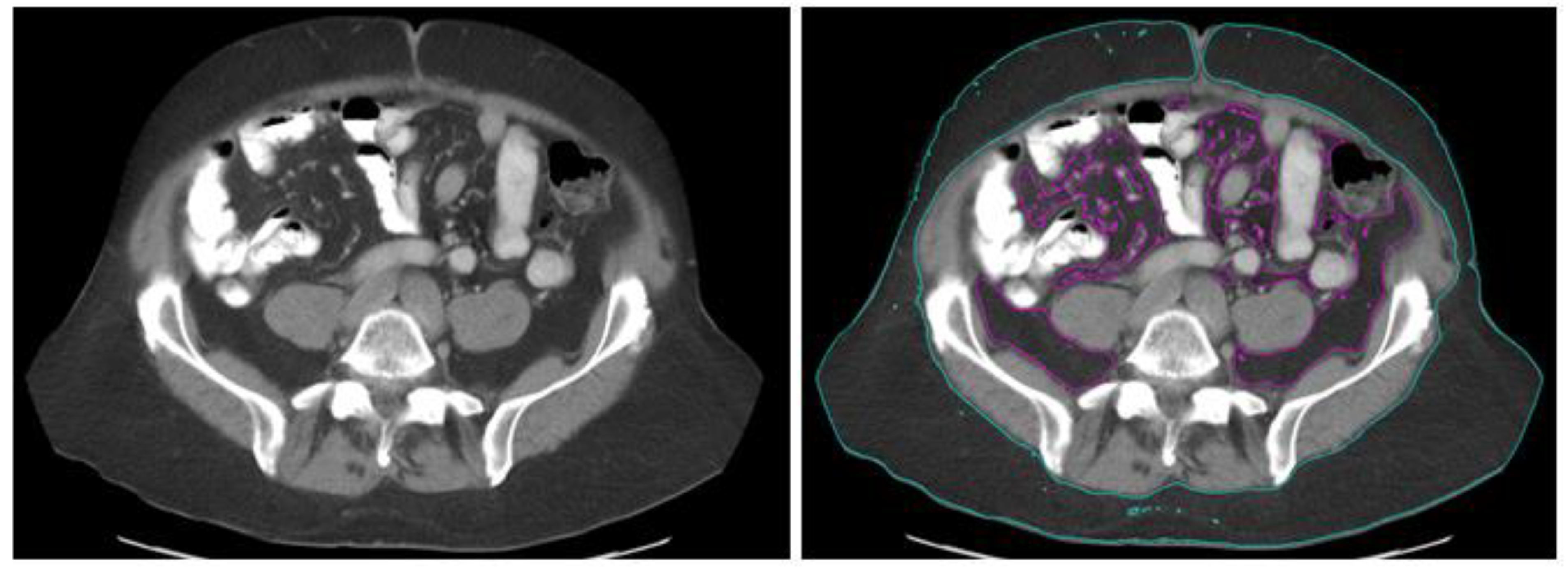 Cancers 15 02329 g001 Cancers 15 02329 g001