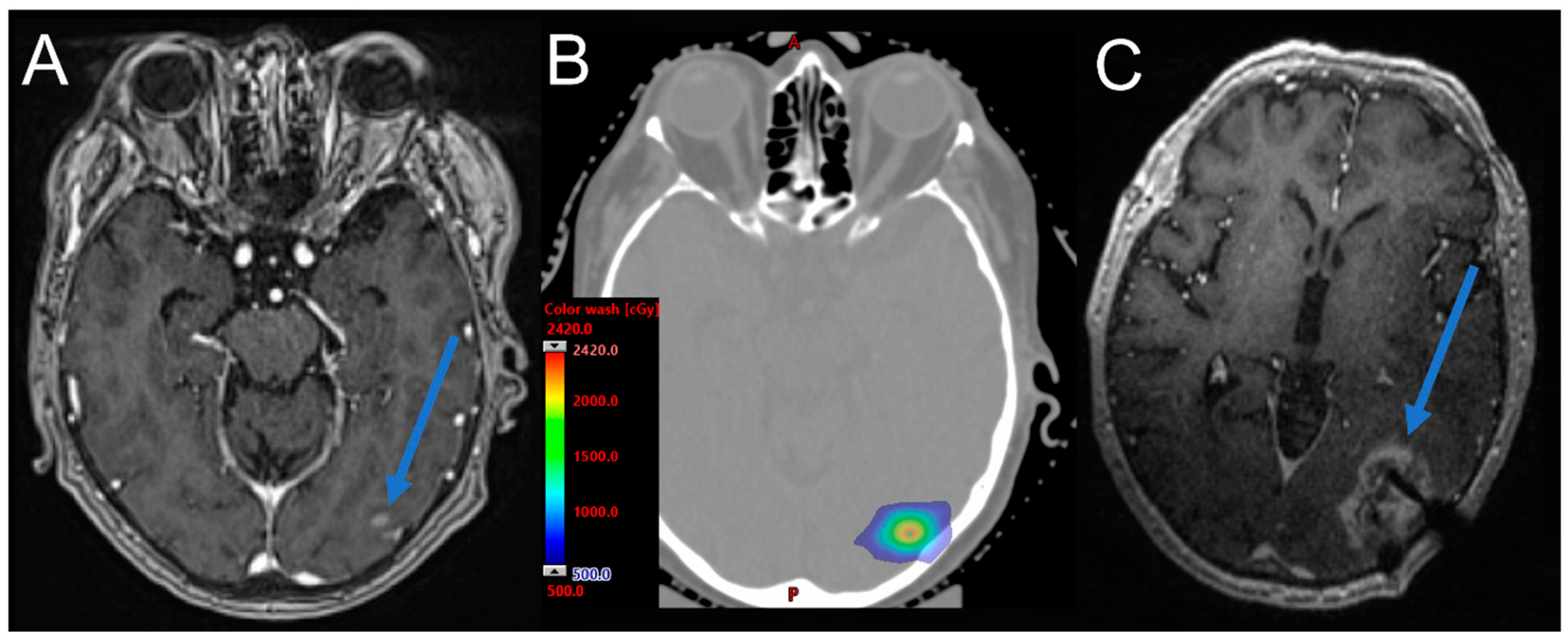Cancers 15 02432 g003