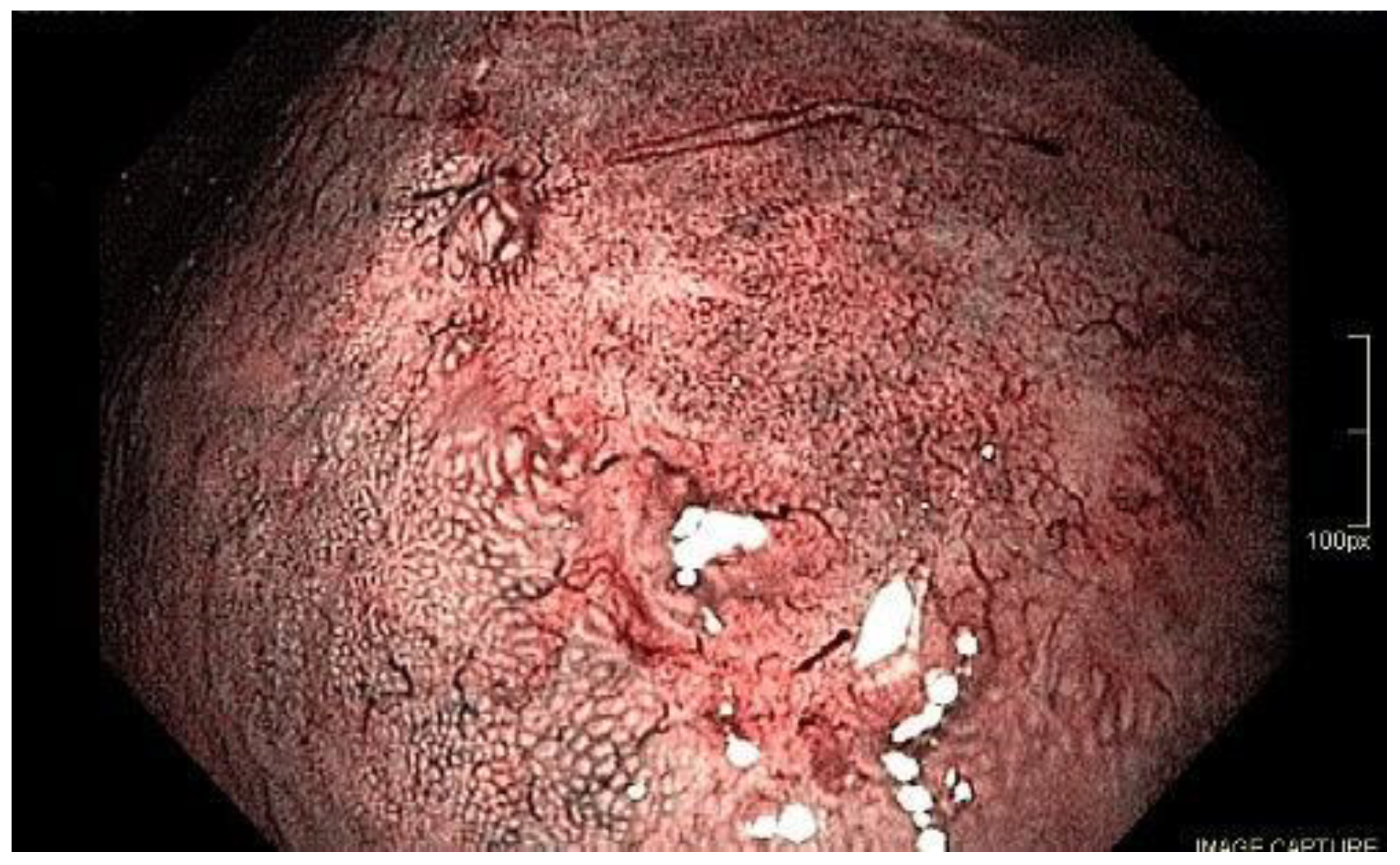 Cancers 15 02445 g008 Cancers 15 02445 g008