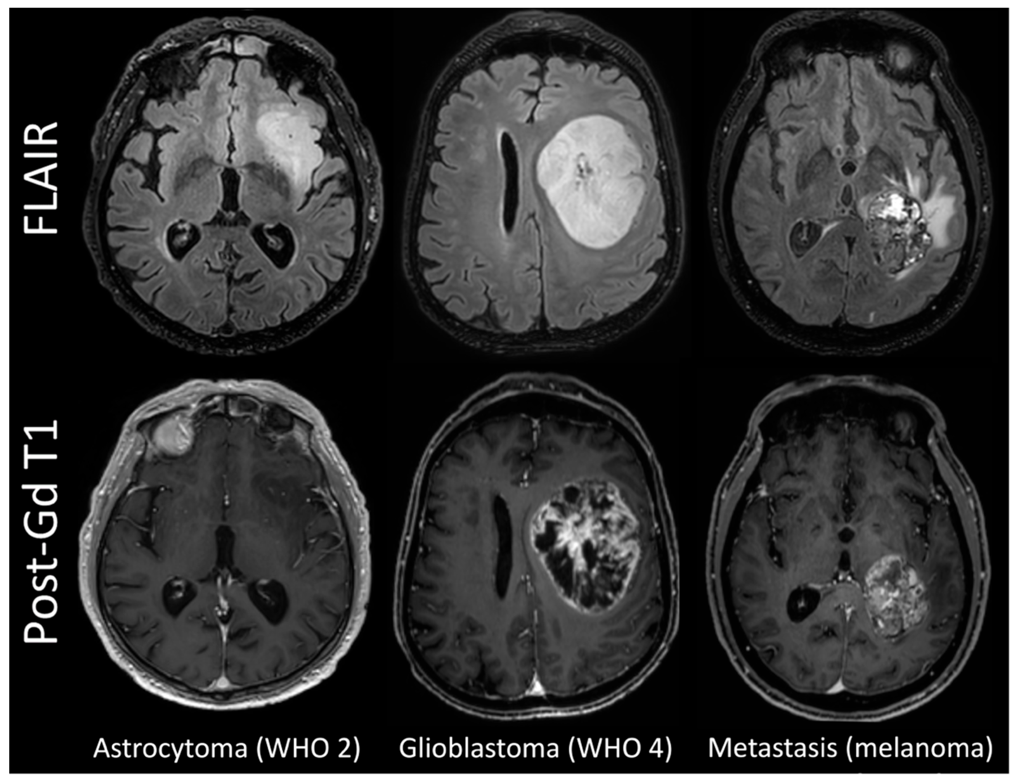 Cancers 15 02490 g001 Cancers 15 02490 g001