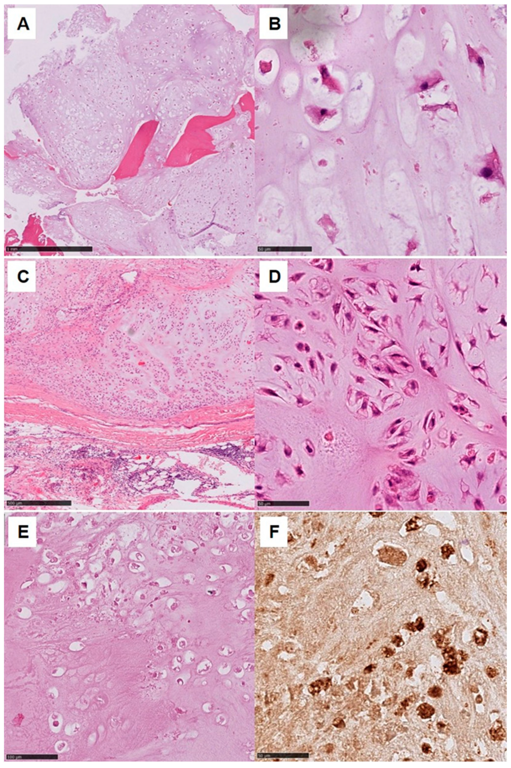 Cancers 15 02556 g002