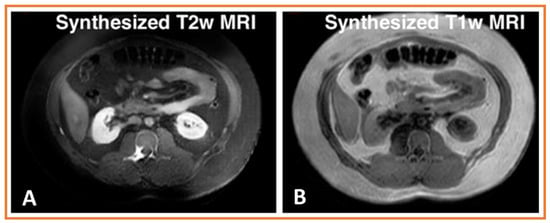 AI-powered interpretable imaging phenotypes noninvasively