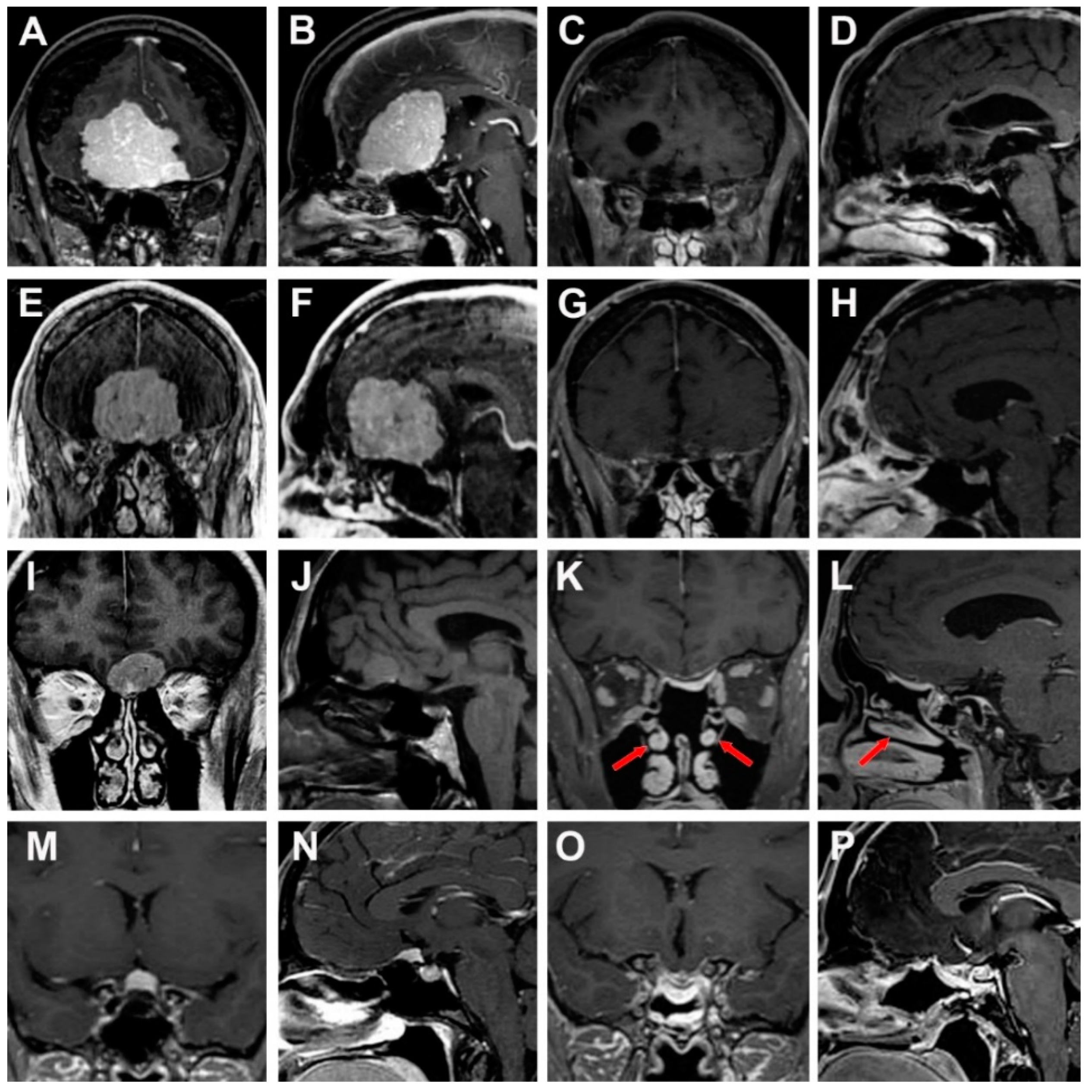 Cancers 15 02587 g005 Cancers 15 02587 g005