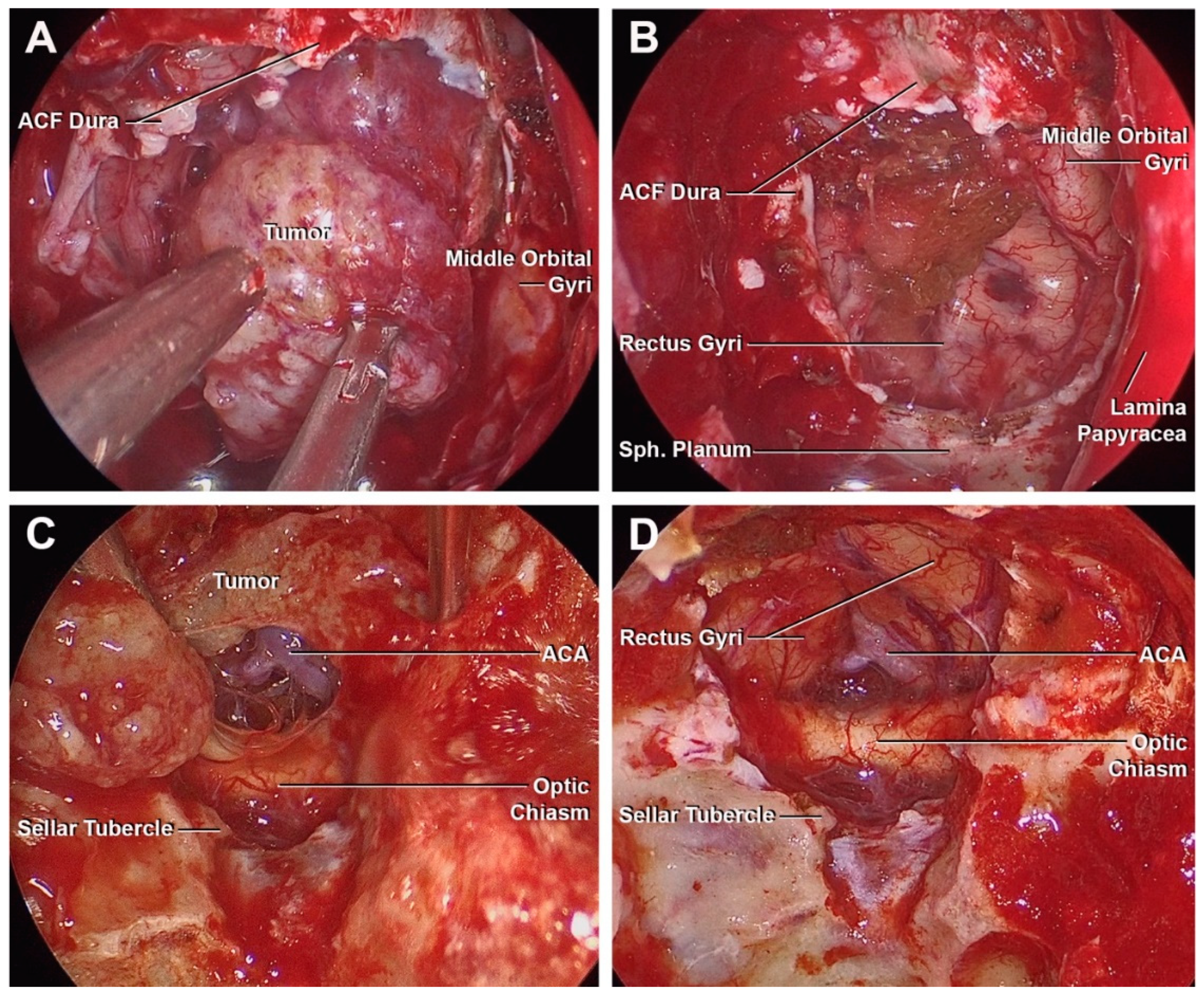 Cancers 15 02587 g006 Cancers 15 02587 g006