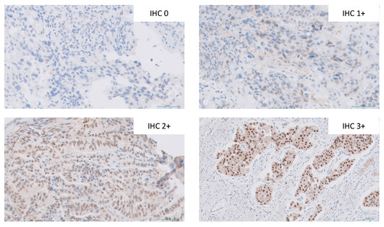 Cancers Free Full Text Female Sex But Not Oestrogen Receptor