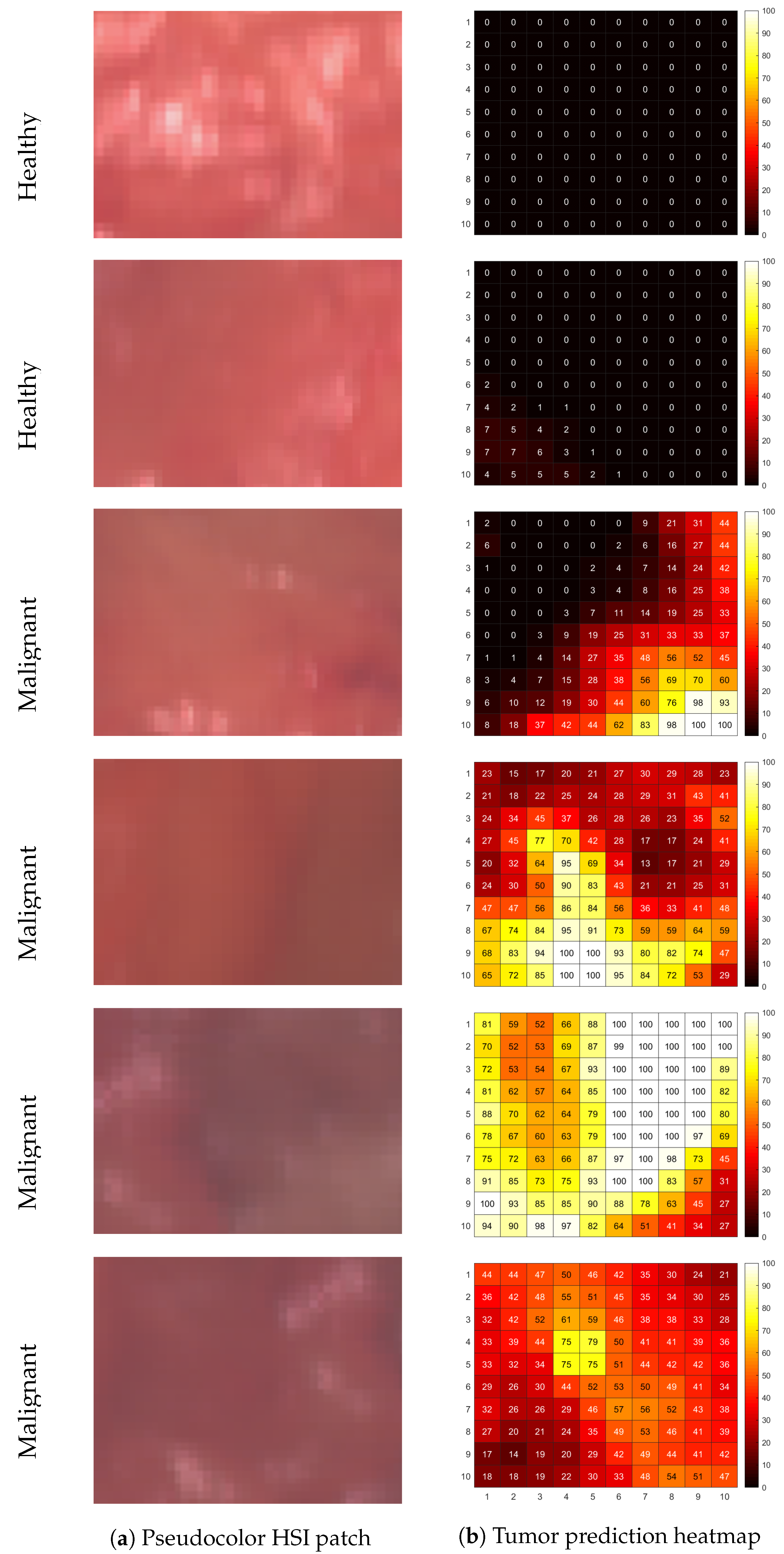 Cancers 15 02679 g004 Cancers 15 02679 g004