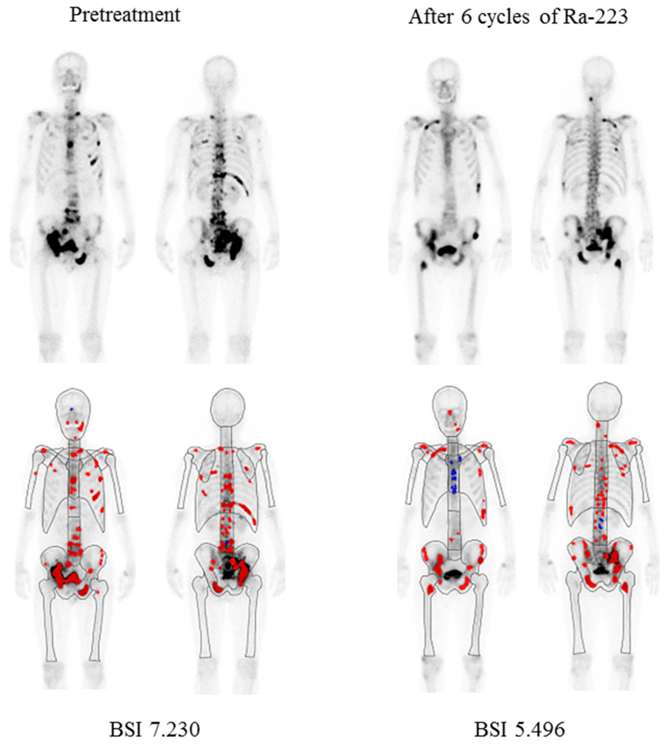 Cancers 15 02784 g001 Cancers 15 02784 g001