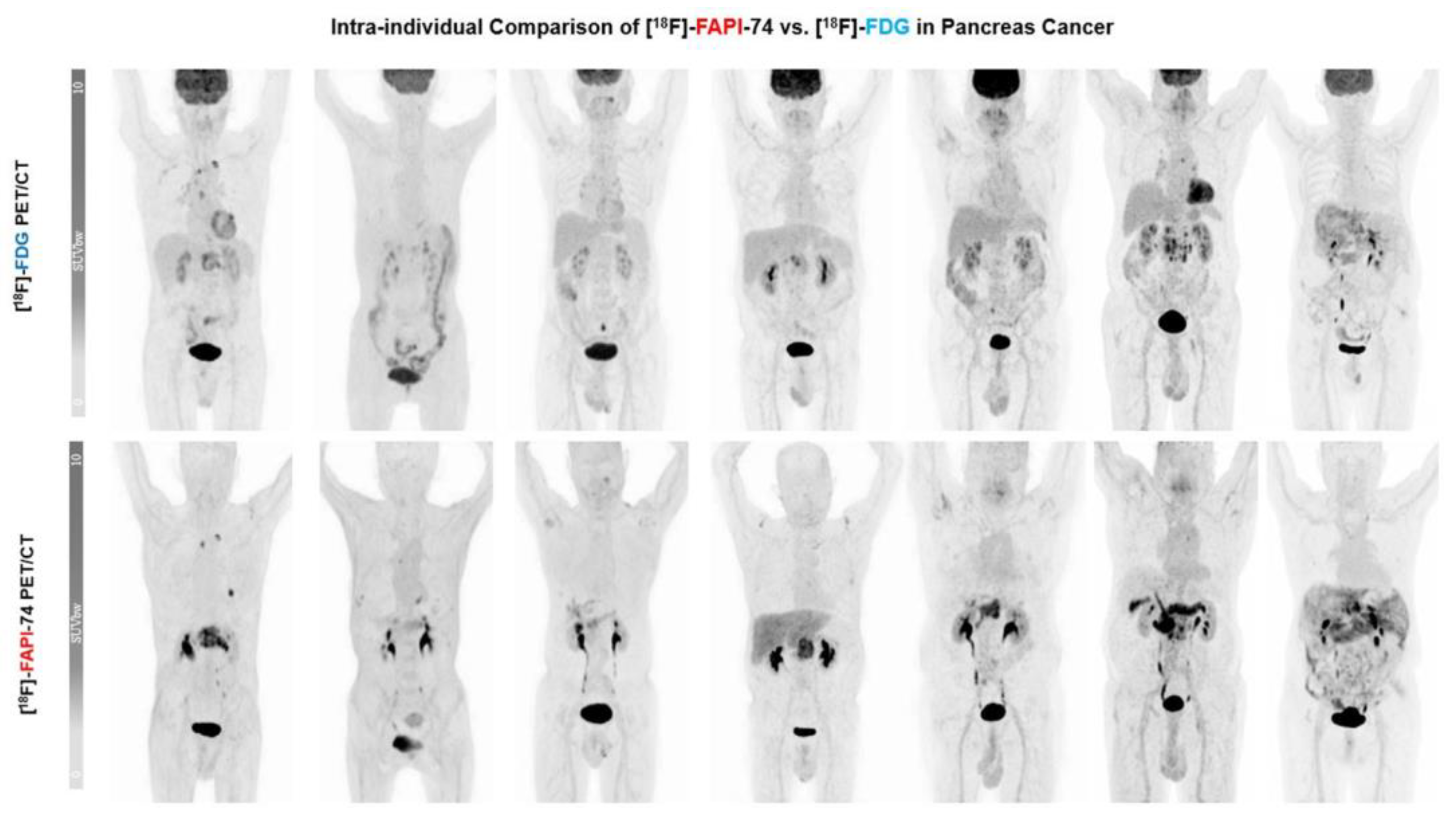 Cancers 15 02798 g006 Cancers 15 02798 g006