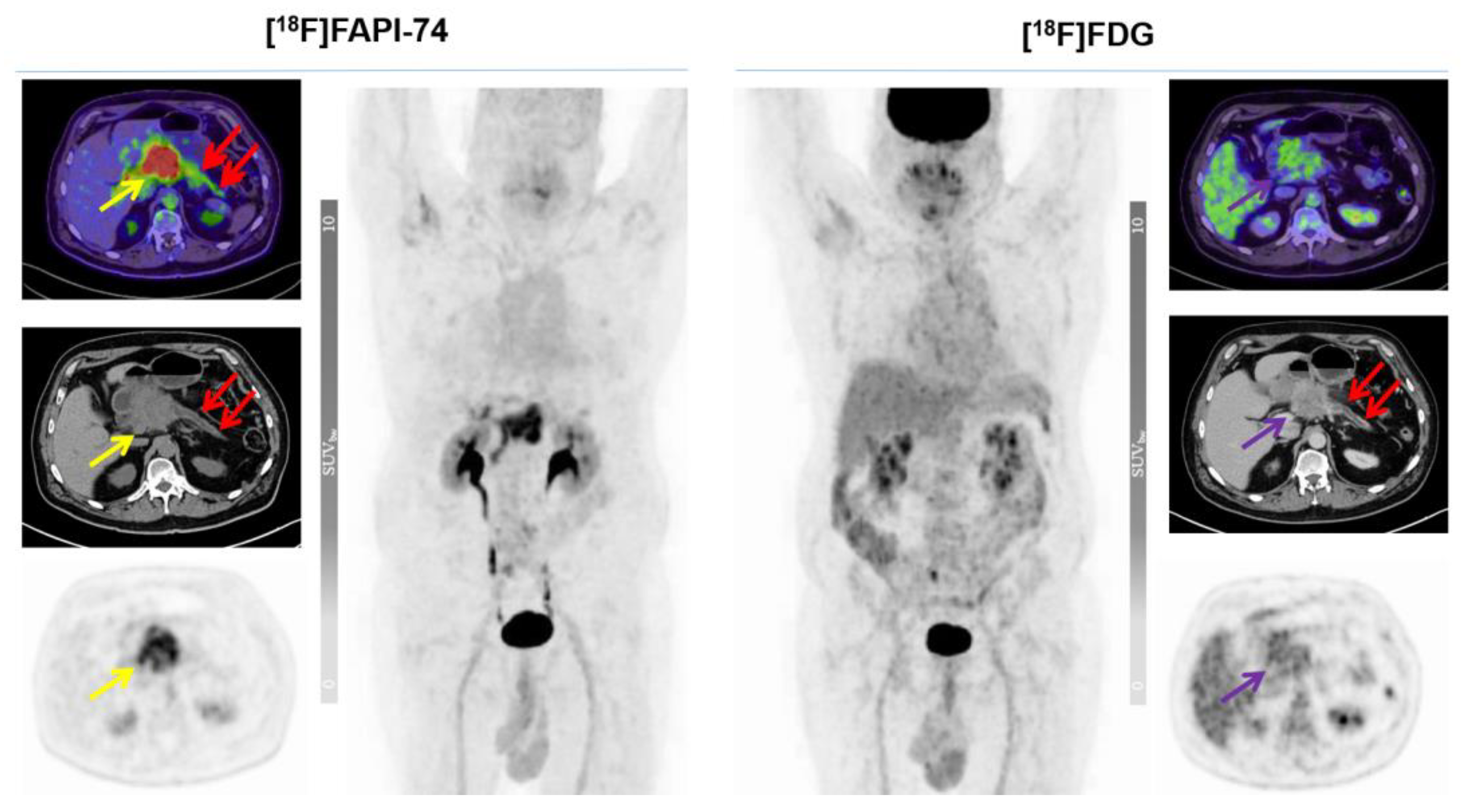 Cancers 15 02798 g007 Cancers 15 02798 g007