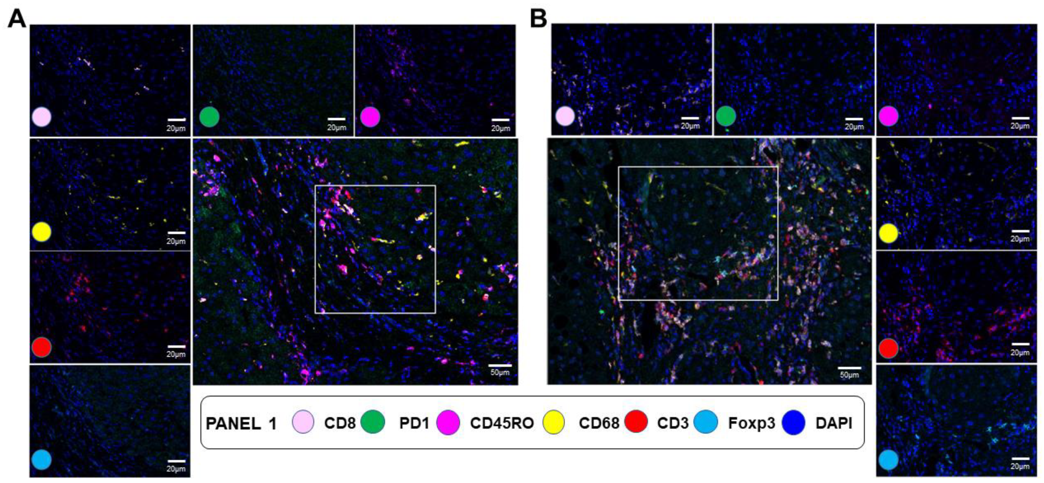 Cancers 15 02871 g005 Cancers 15 02871 g005
