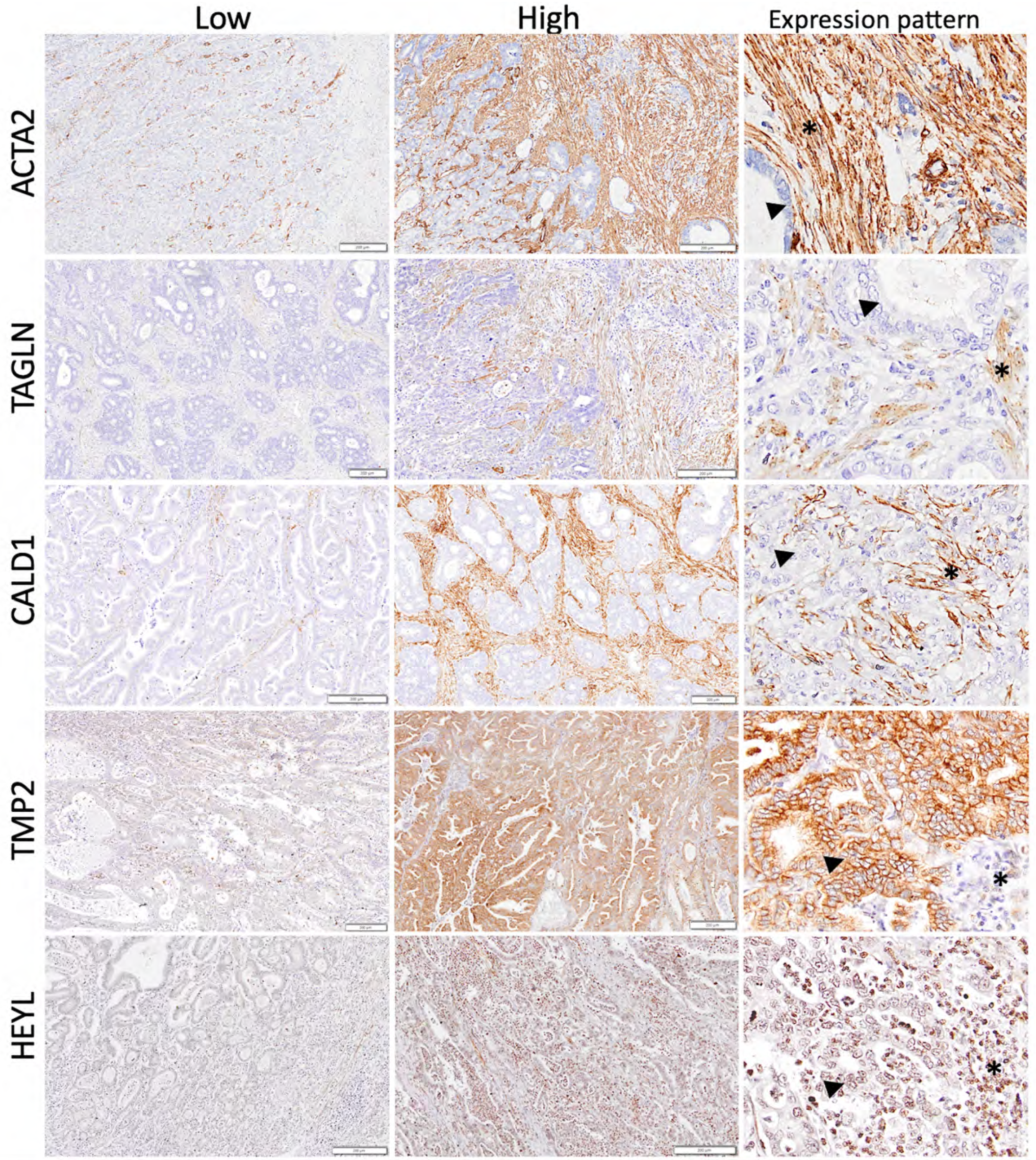 Cancers 15 03035 g004 Cancers 15 03035 g004