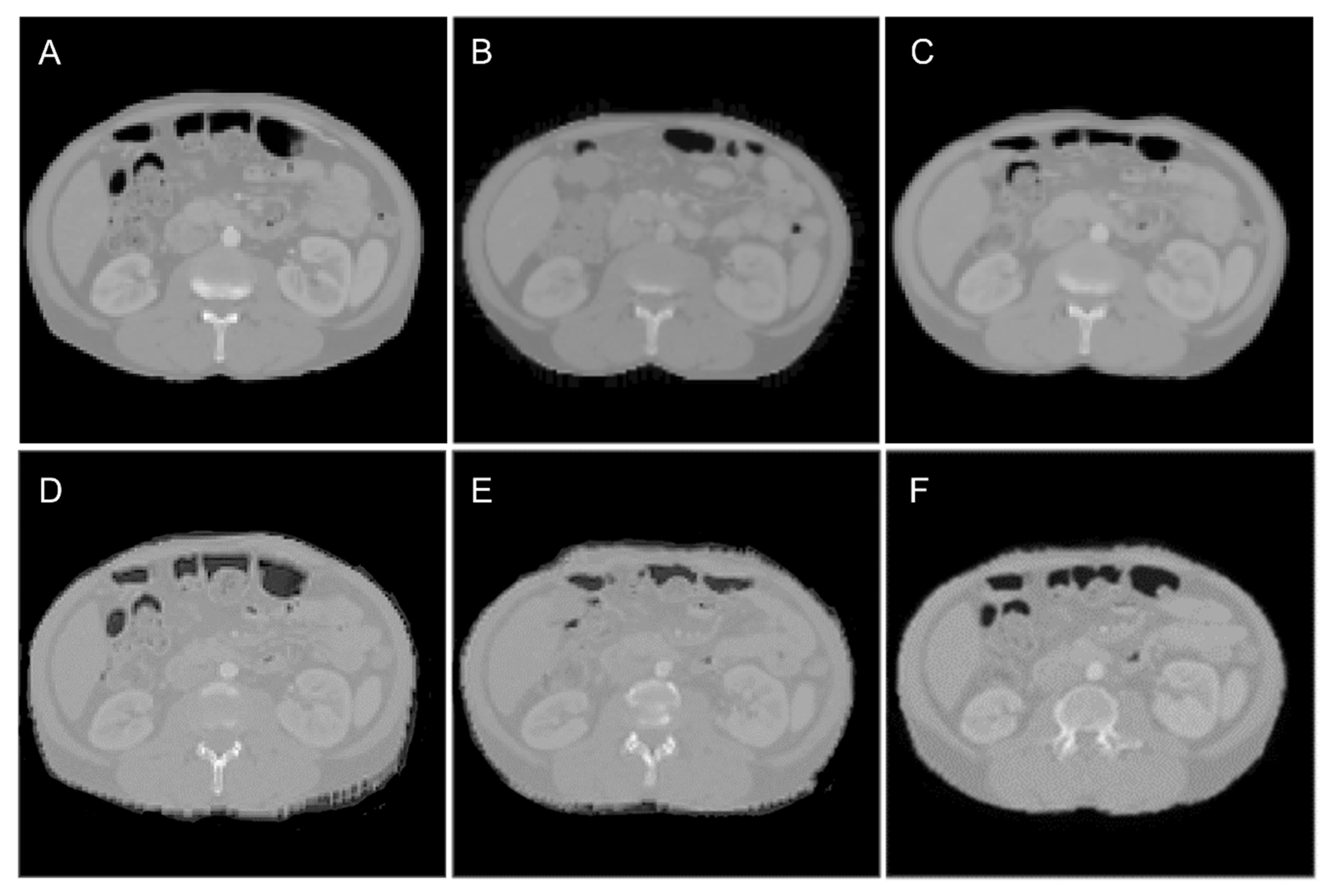 Cancers 15 03061 g005 Cancers 15 03061 g005