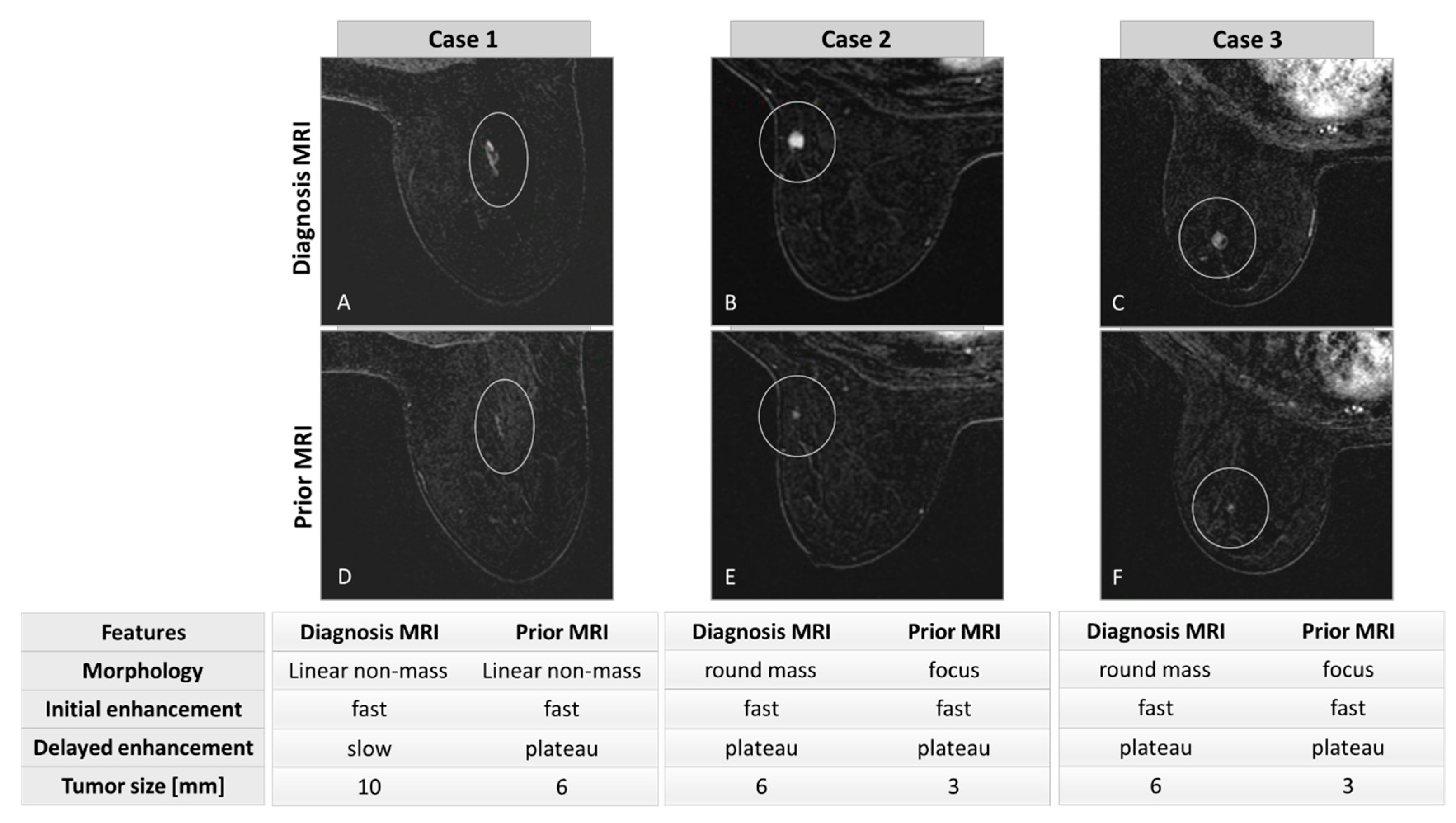 Safe, painless early breast-cancer detection is on the way - ISRAEL21c