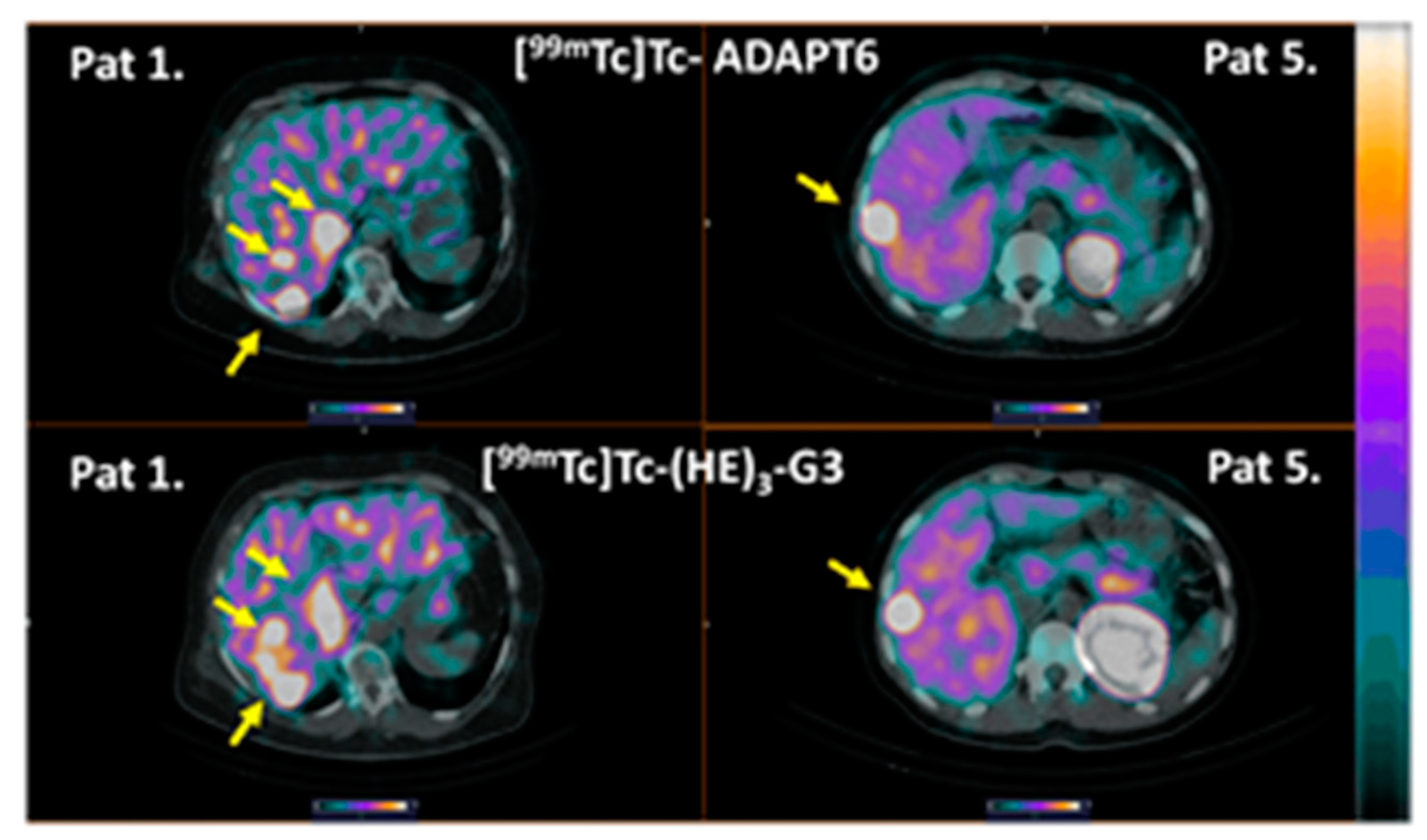 Cancers 15 03149 g009