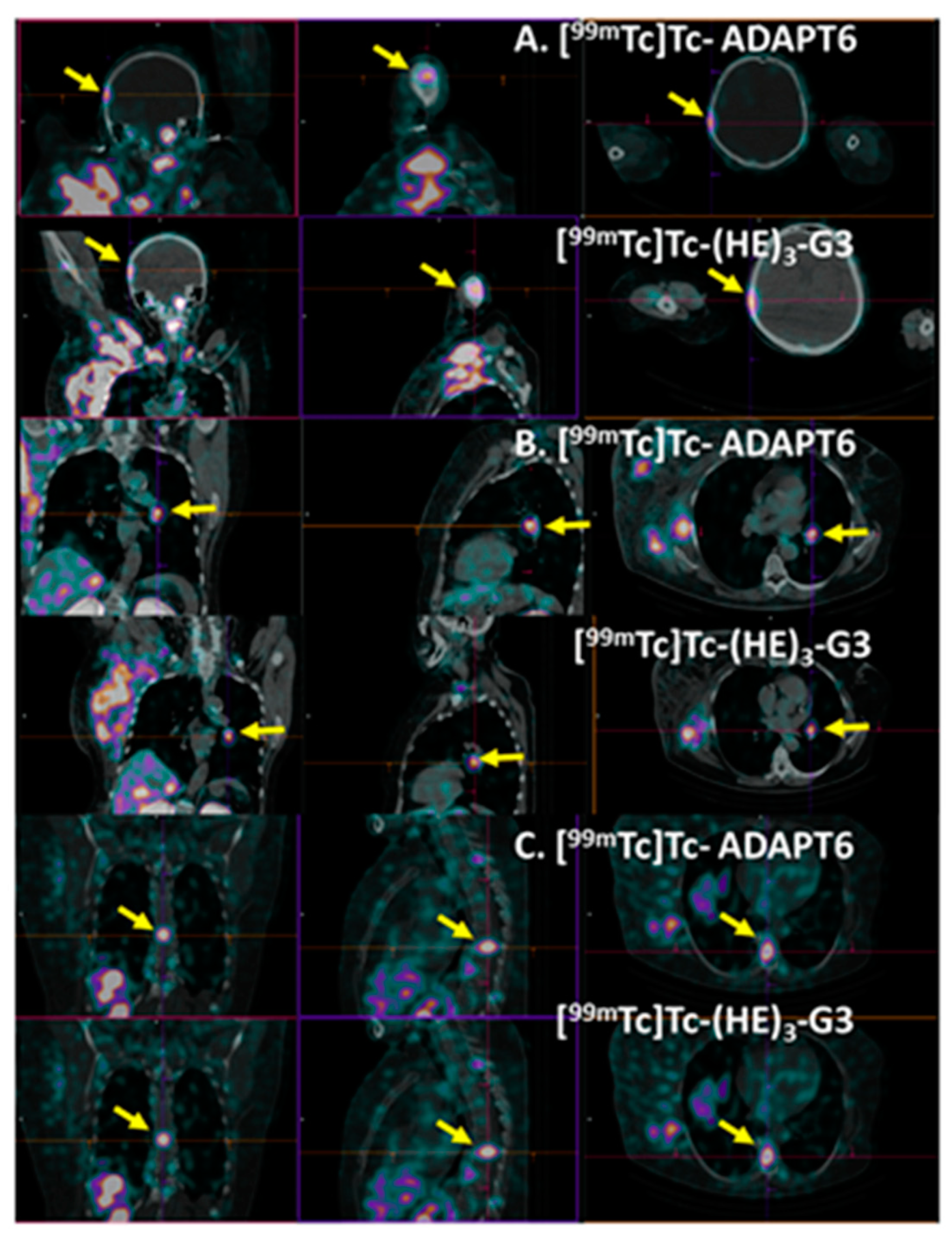 Cancers 15 03149 g011