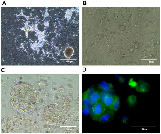 Cancers | Free Full-Text | Preclinical Models Of Neuroblastoma—Current ...