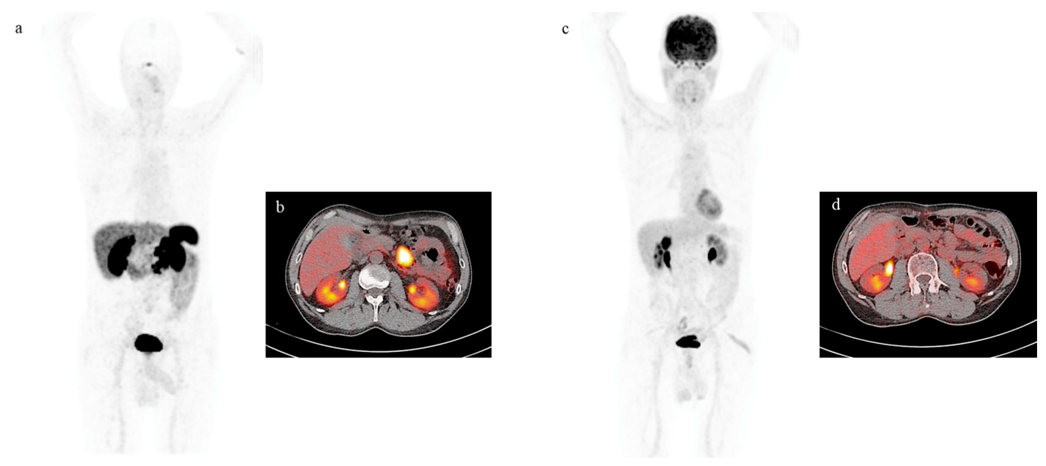 Cancers 15 03483 g002 Cancers 15 03483 g002