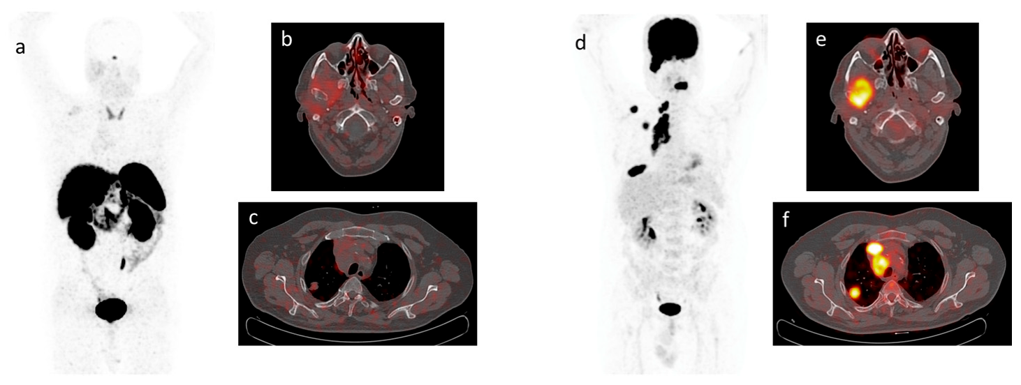 Cancers 15 03483 g003 Cancers 15 03483 g003