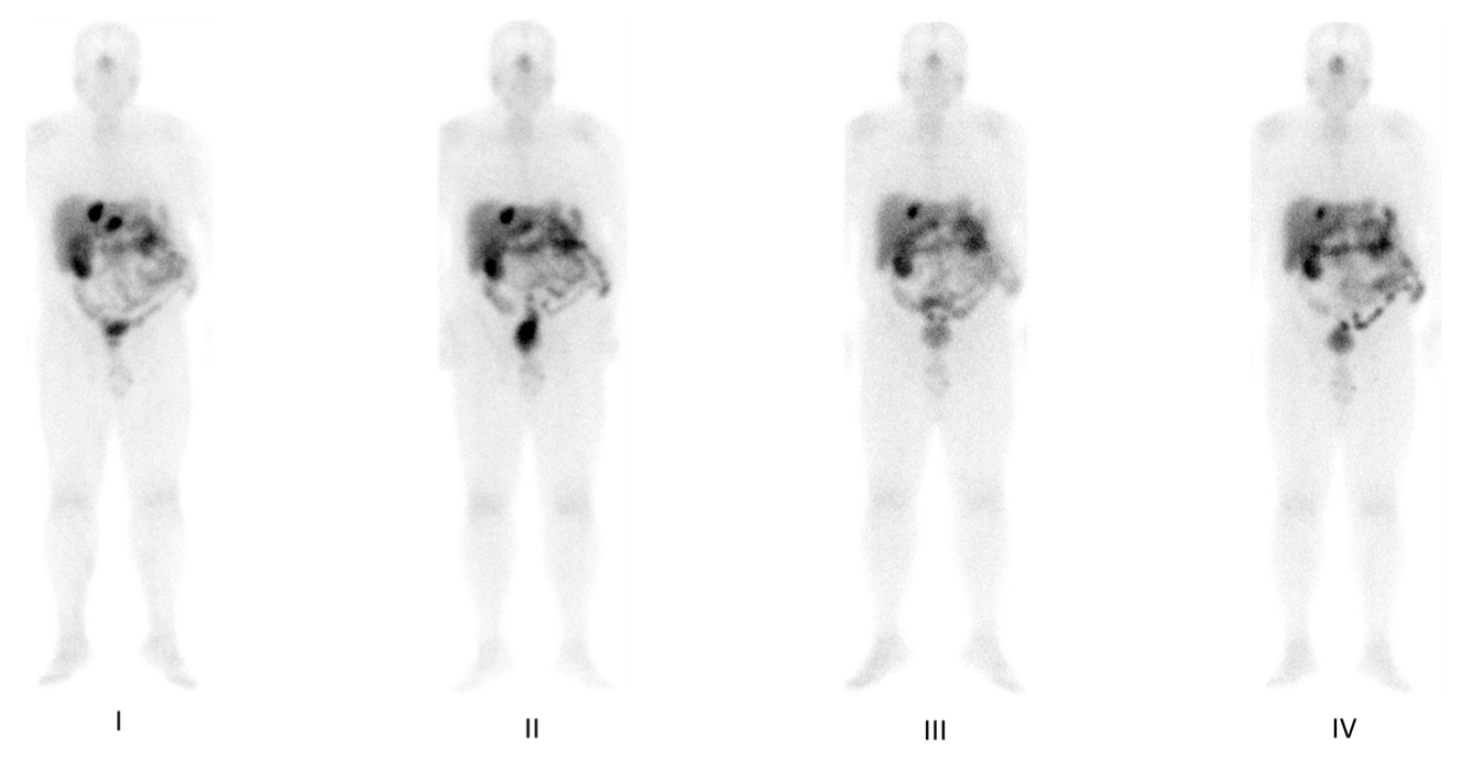 Cancers 15 03483 g004 Cancers 15 03483 g004