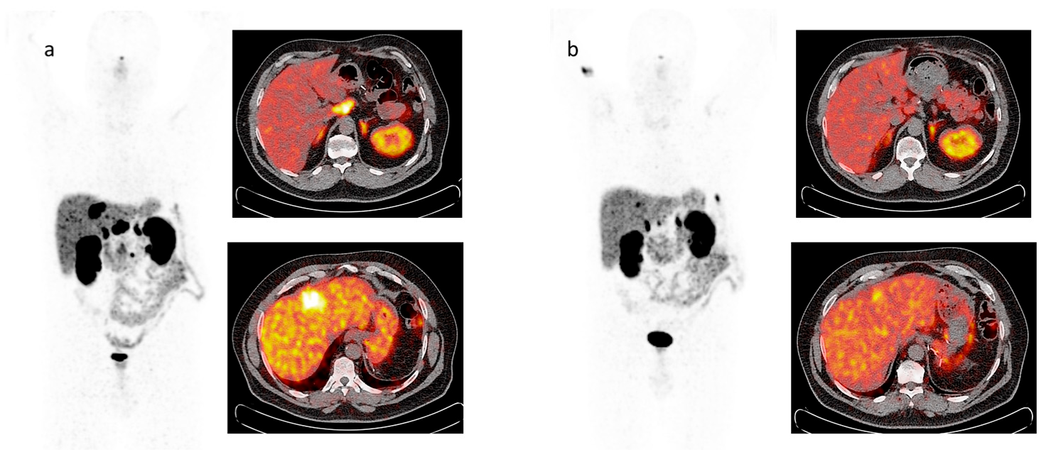 Cancers 15 03483 g005 Cancers 15 03483 g005