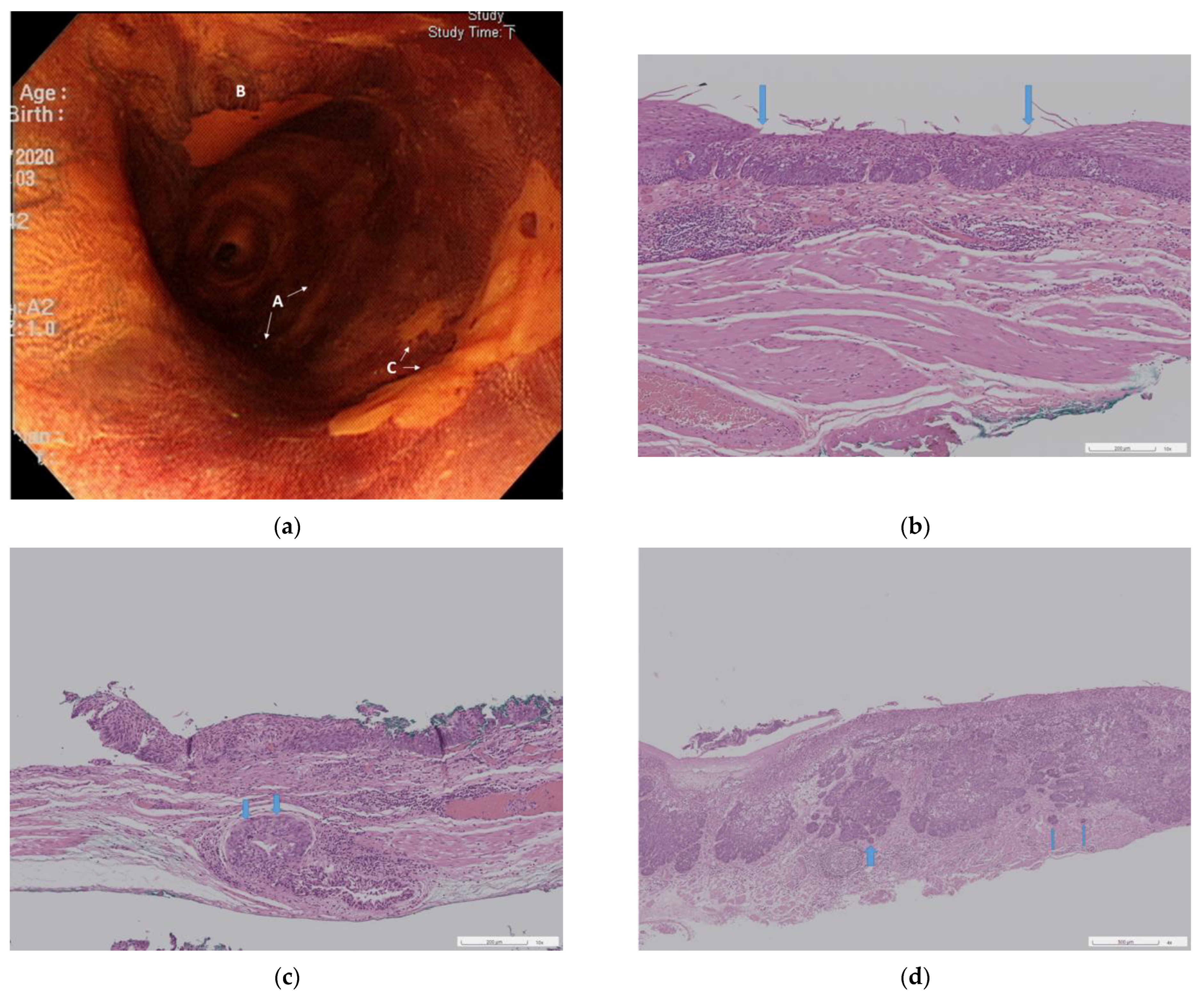 Cancers 15 03558 g002 Cancers 15 03558 g002