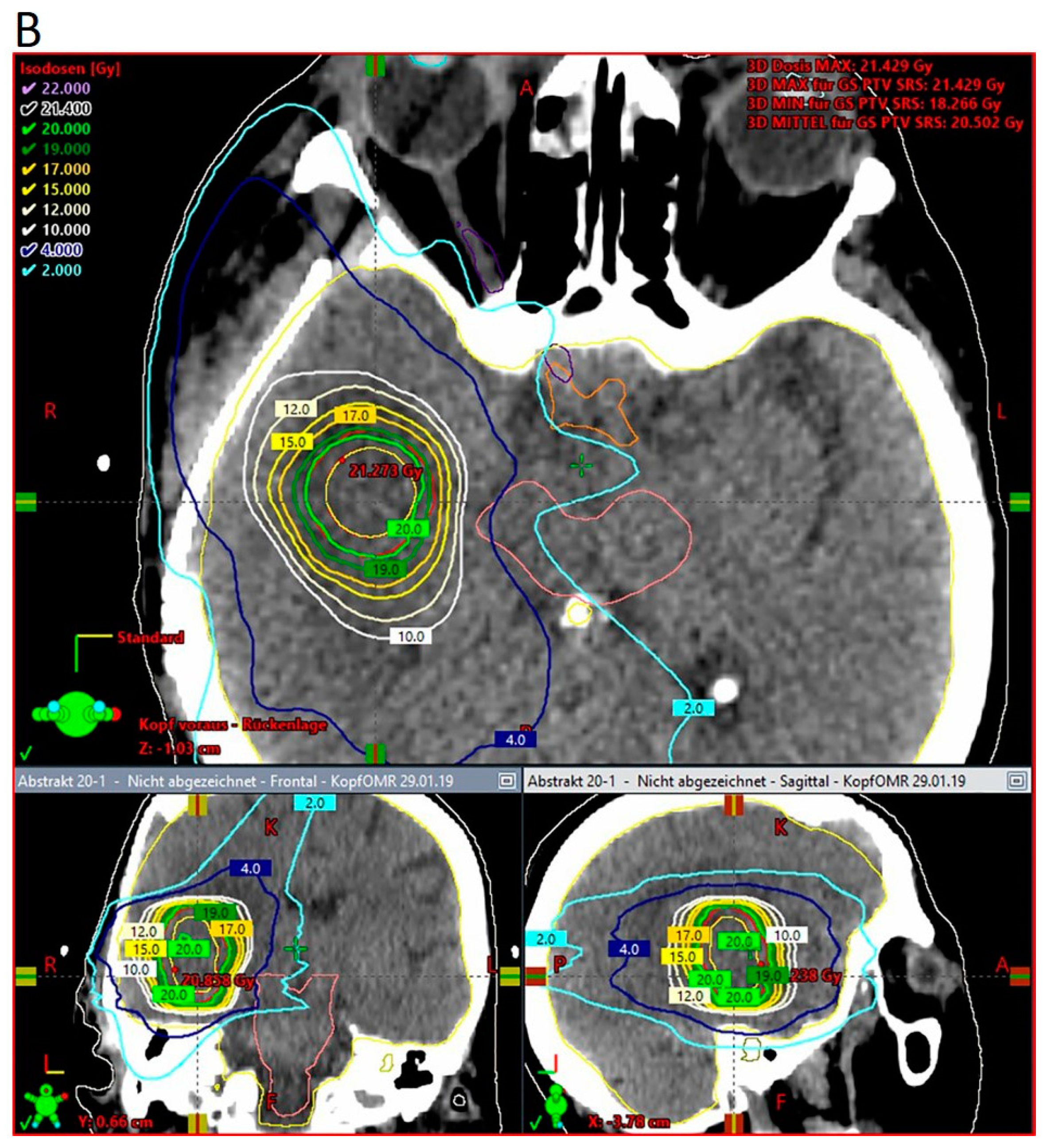 Cancers 15 03670 g002b