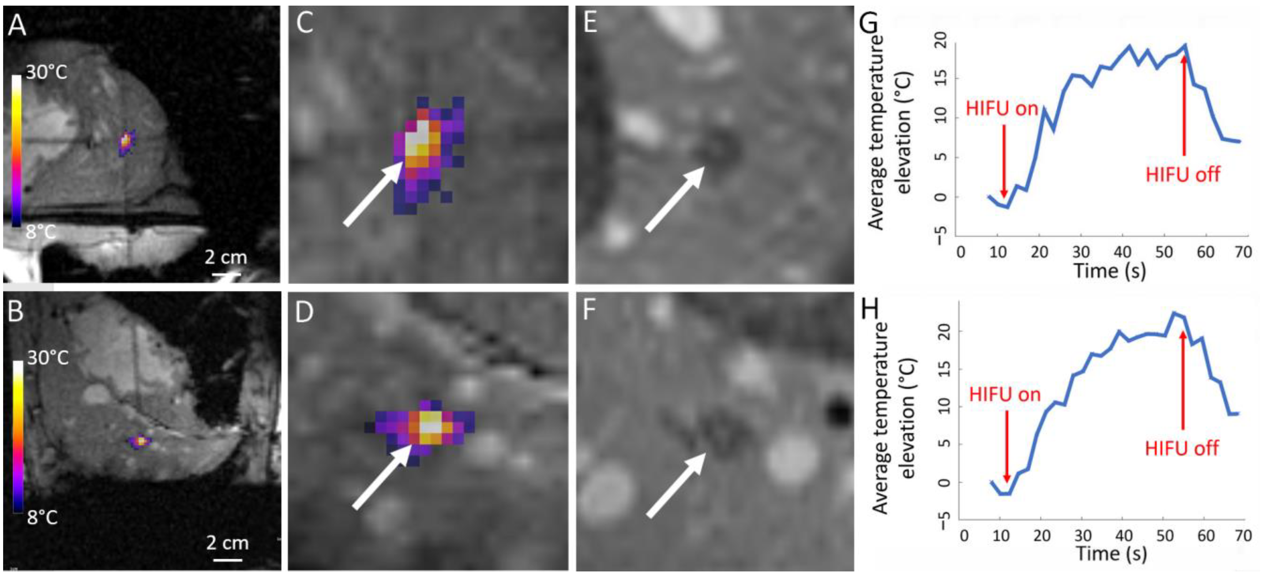 Cancers 15 03961 g004