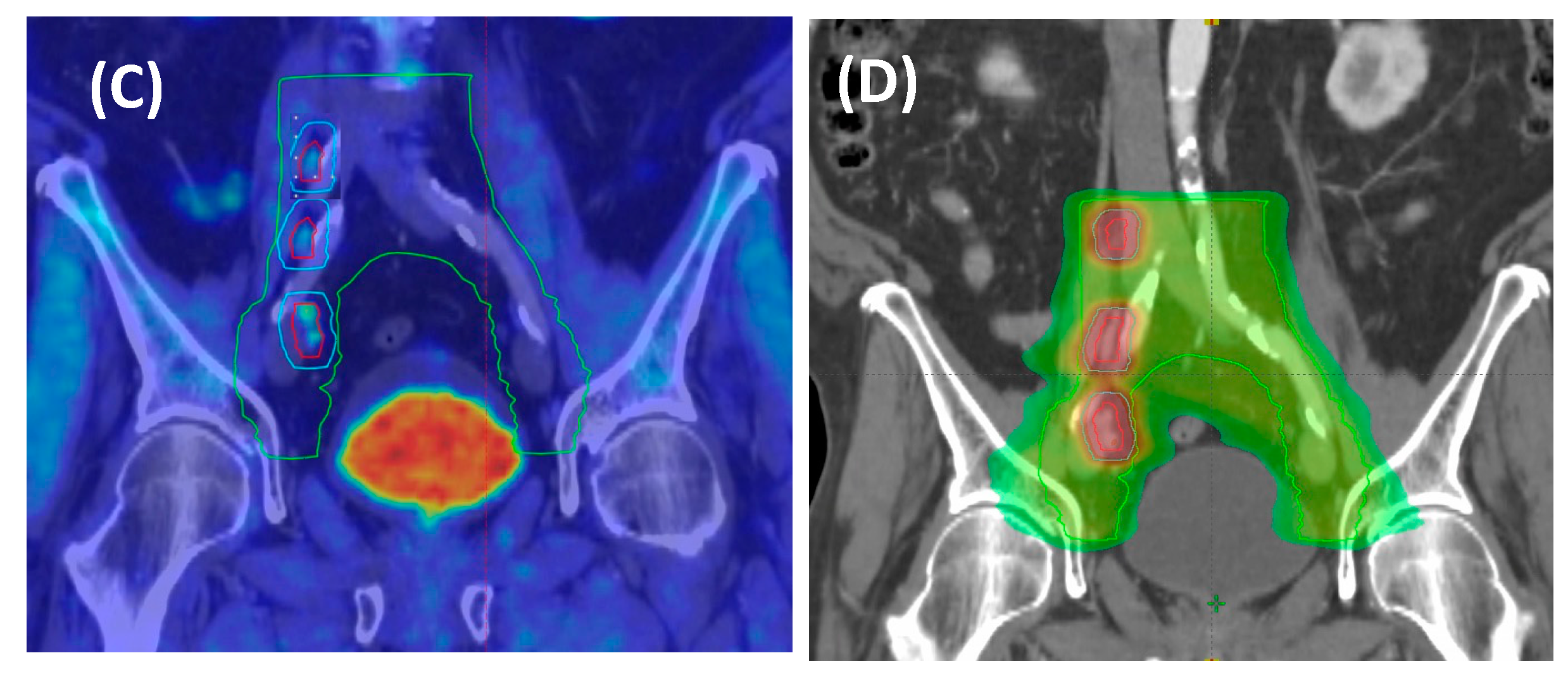 Cancers 15 04159 g001b